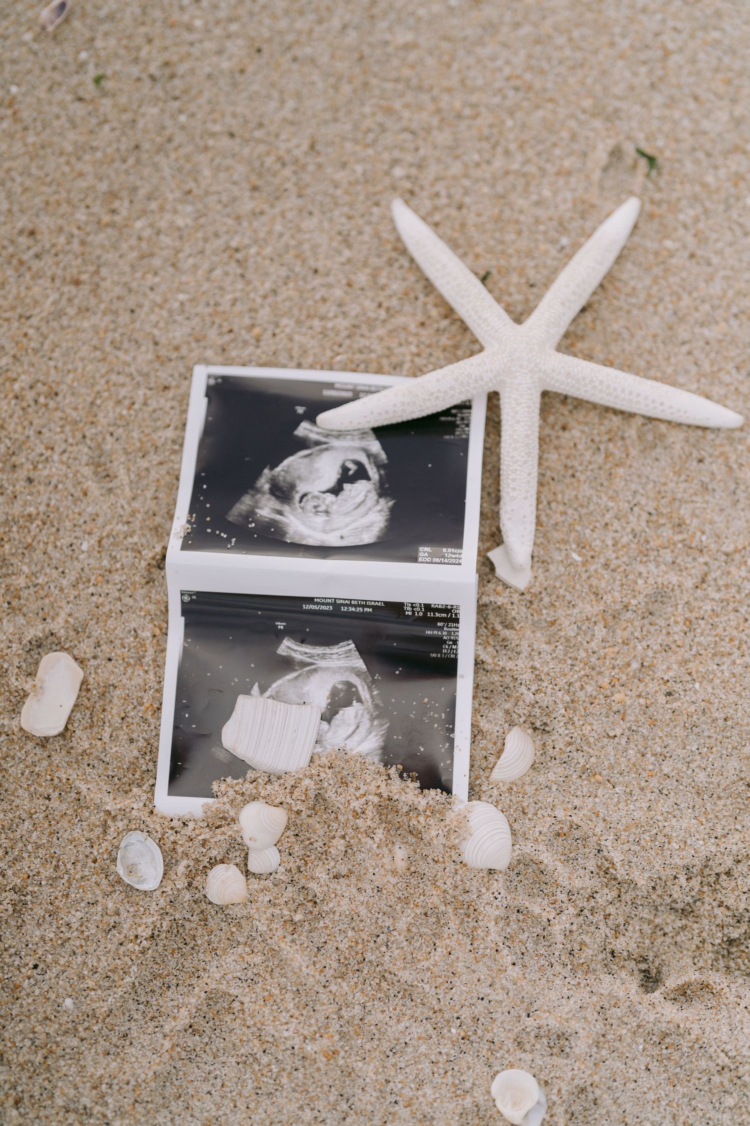 Maternity Session in Hoboken, NJ