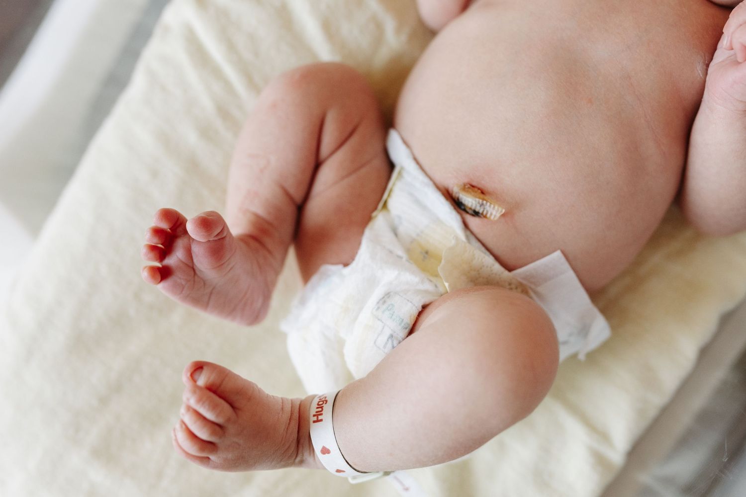 Newborn baby lying on white blanket wearing diaper with hospital identification bracelet on ankle.