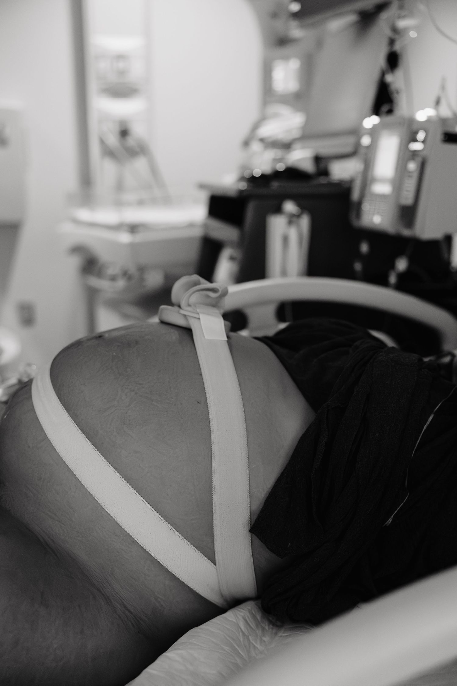 Medical patient wearing monitoring straps and sensors while resting on examination table in black and white.