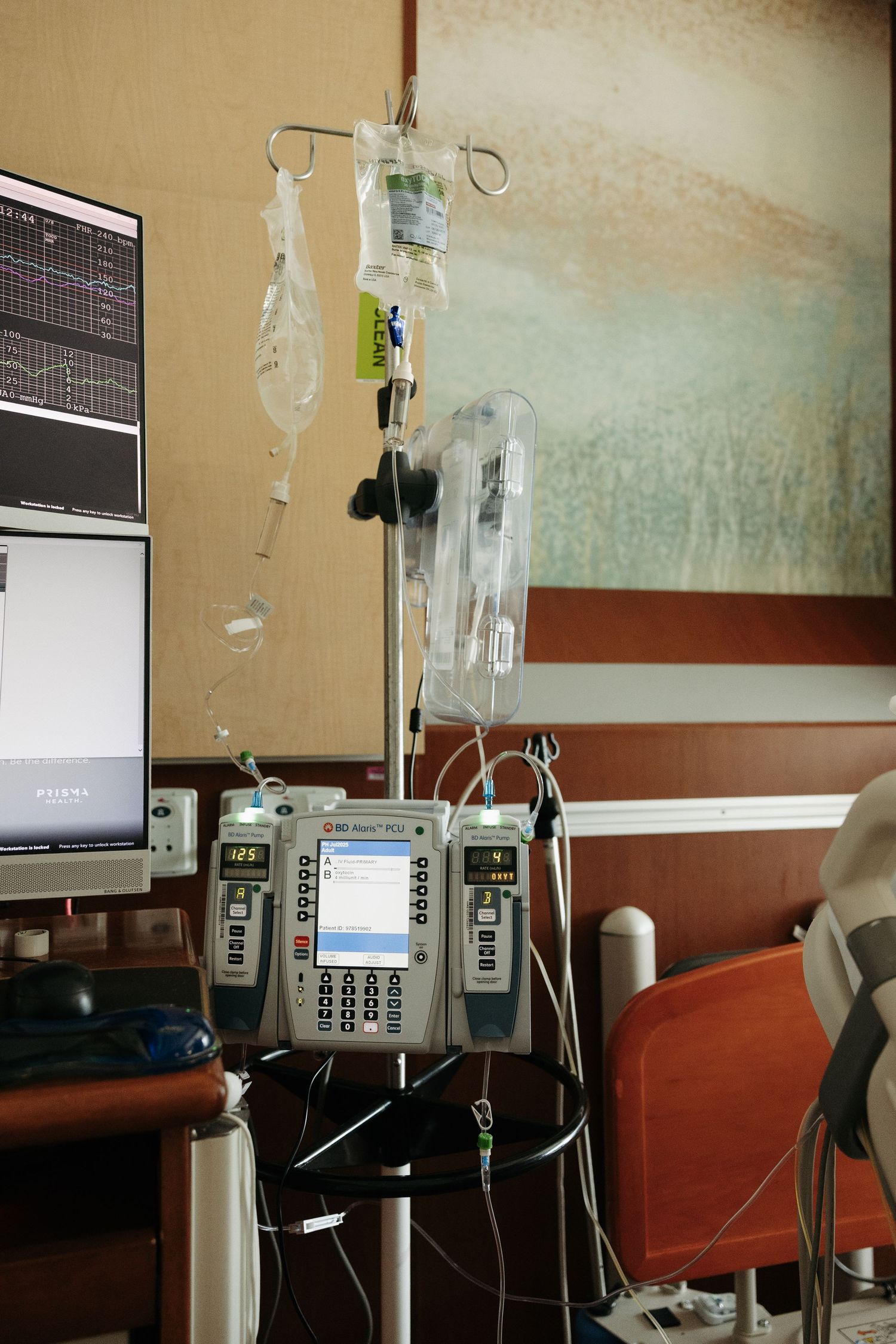 Medical IV drips and monitoring equipment set up in a hospital room with infusion pumps and digital displays.