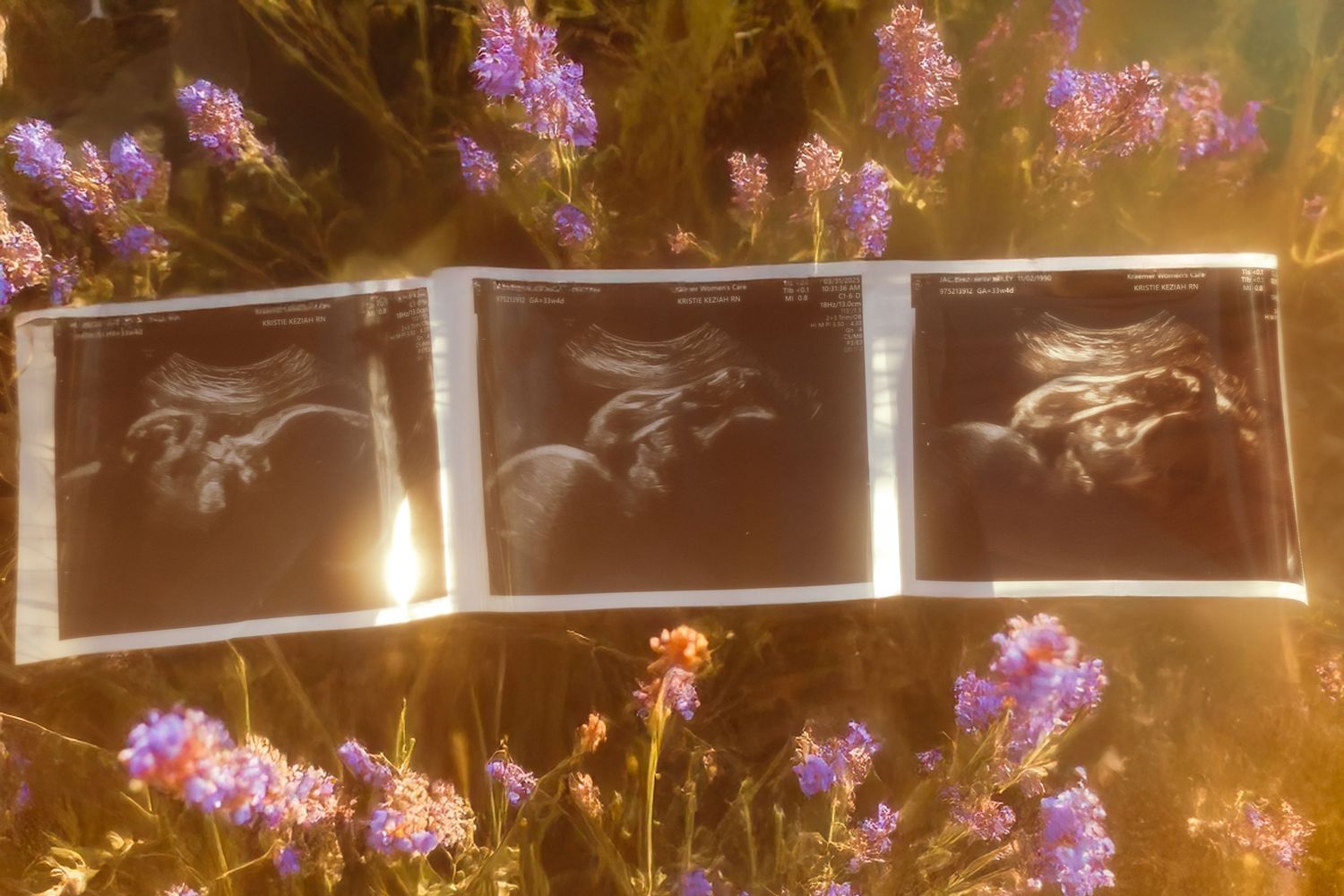 Ultrasound photos displayed among purple wildflowers in golden light.