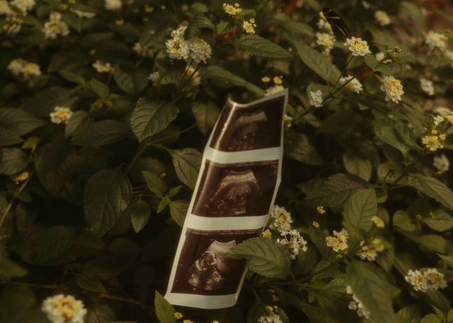 Ultrasound photos resting among green leafy plants with small white flowers in a garden setting.