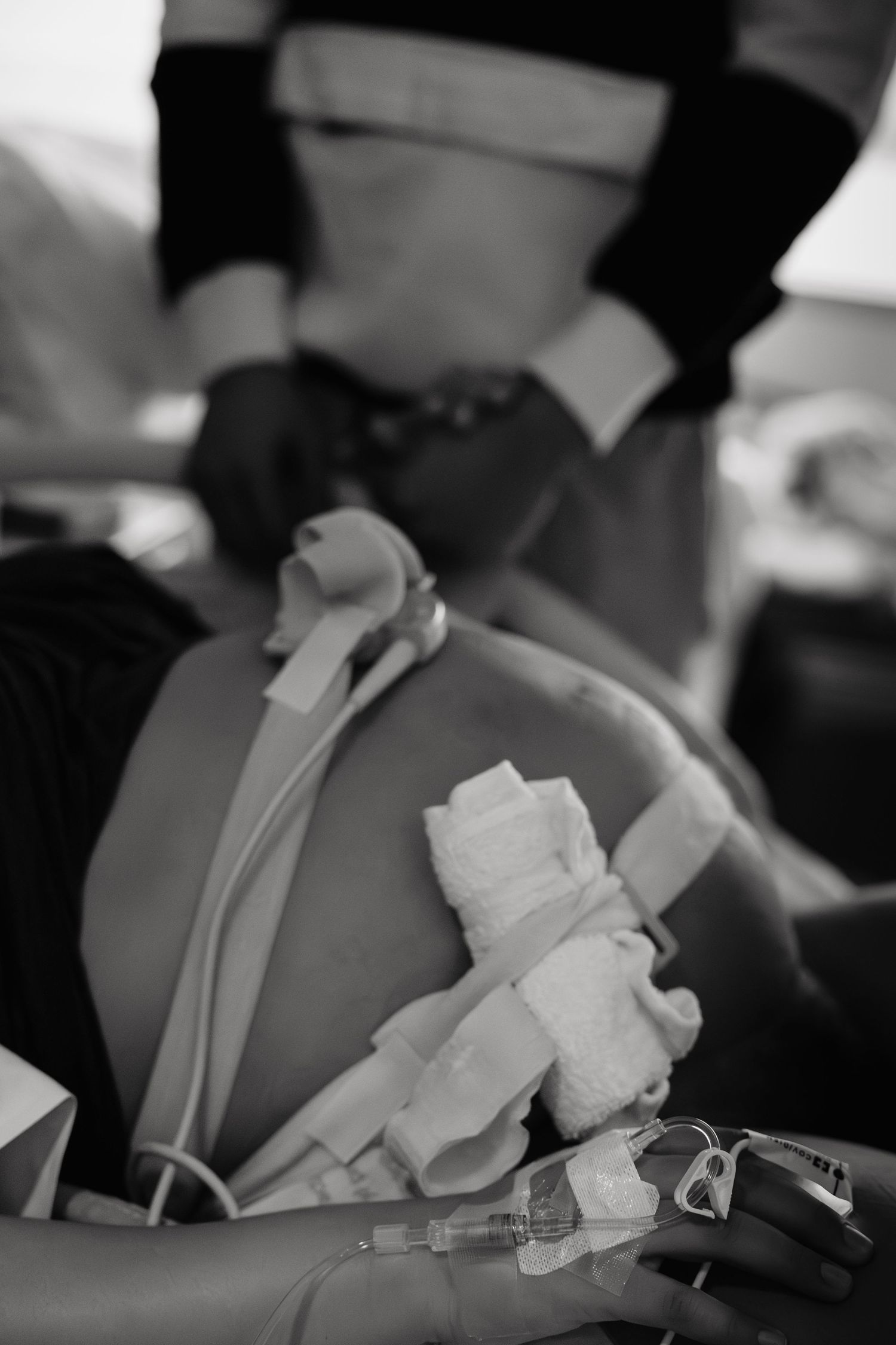 Black and white close-up image of medical equipment and IV tubes attached to a patient's arm during treatment.