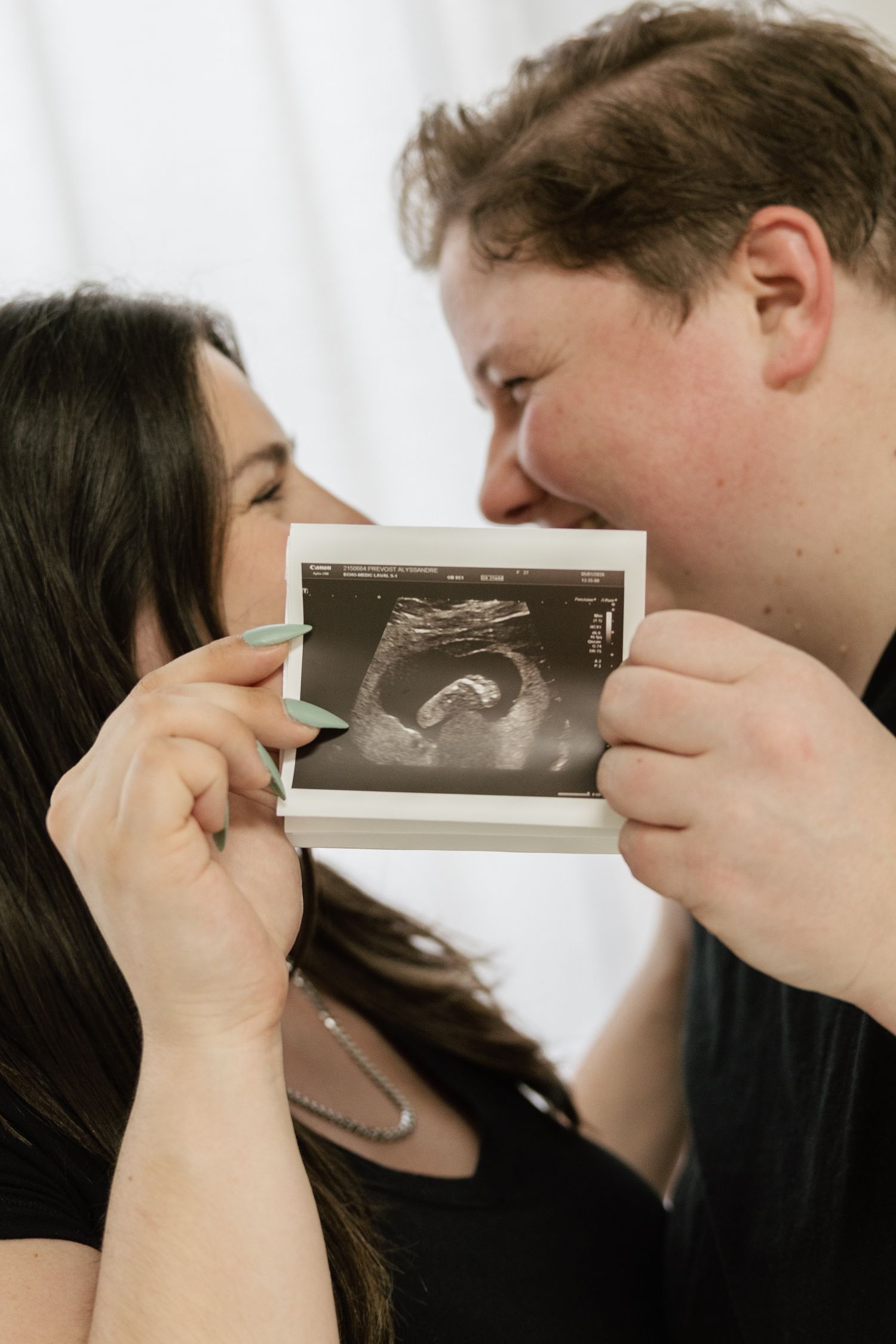 A smiling couple kisses over an ultrasound photo, celebrating their pregnancy announcement.