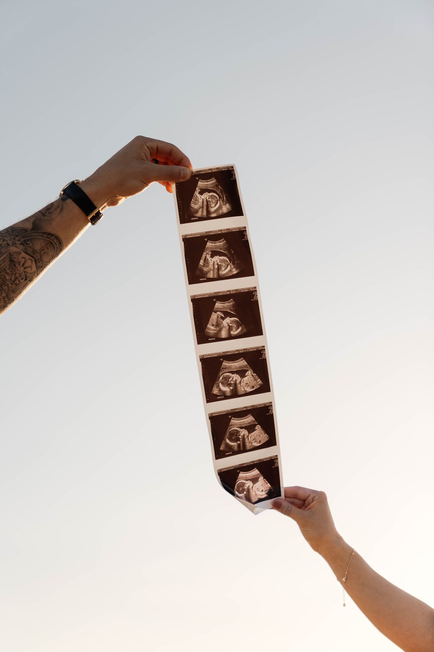 Couple holding ultrasound strip photos up against a clear sky, one hand showing a tattoo and watch in Penticton