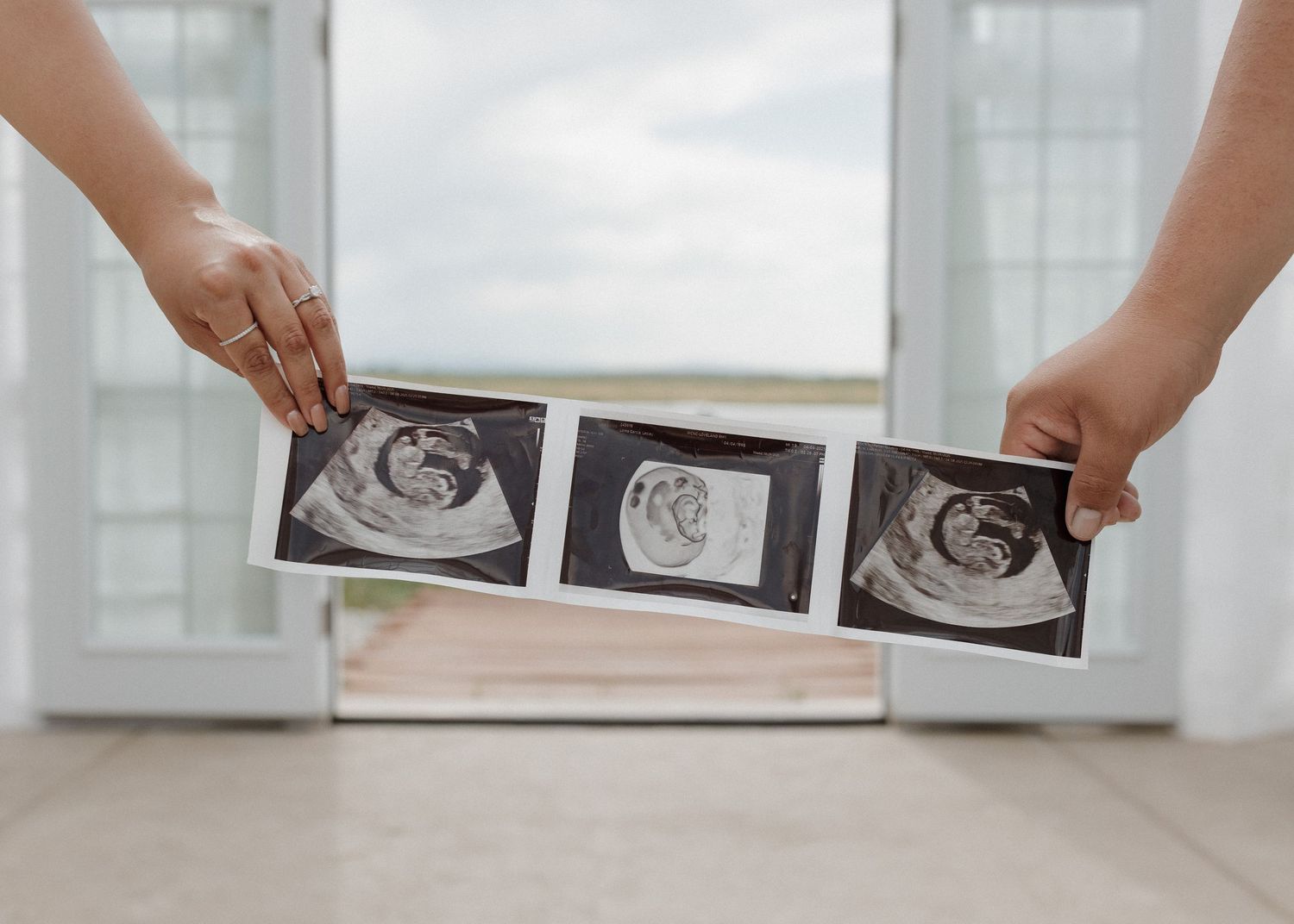 Hands holding ultrasound scan photos showing three stages of pregnancy development against a bright window background.