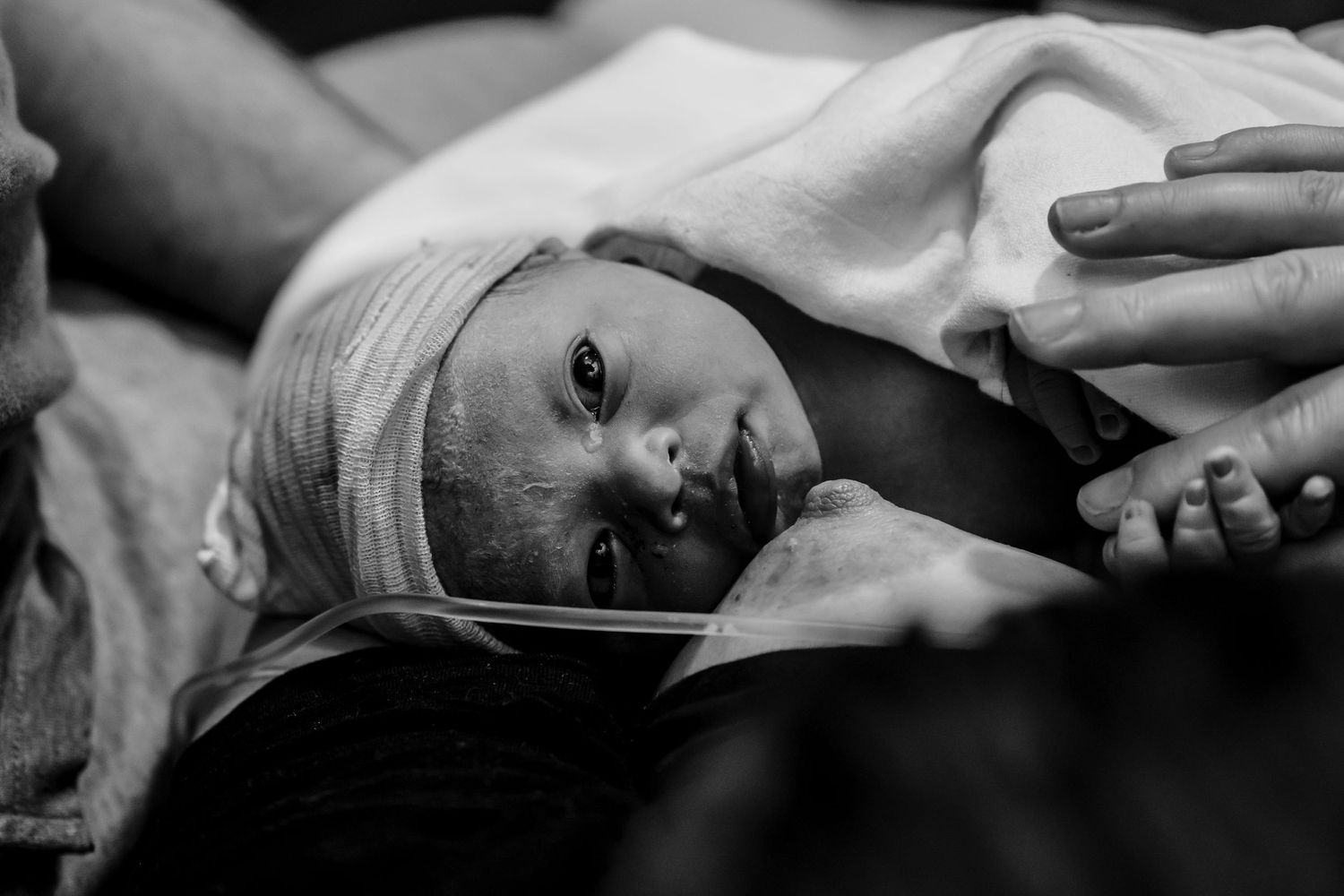 A patient with a bandaged head lies resting on a medical bed captured in black and white photography.