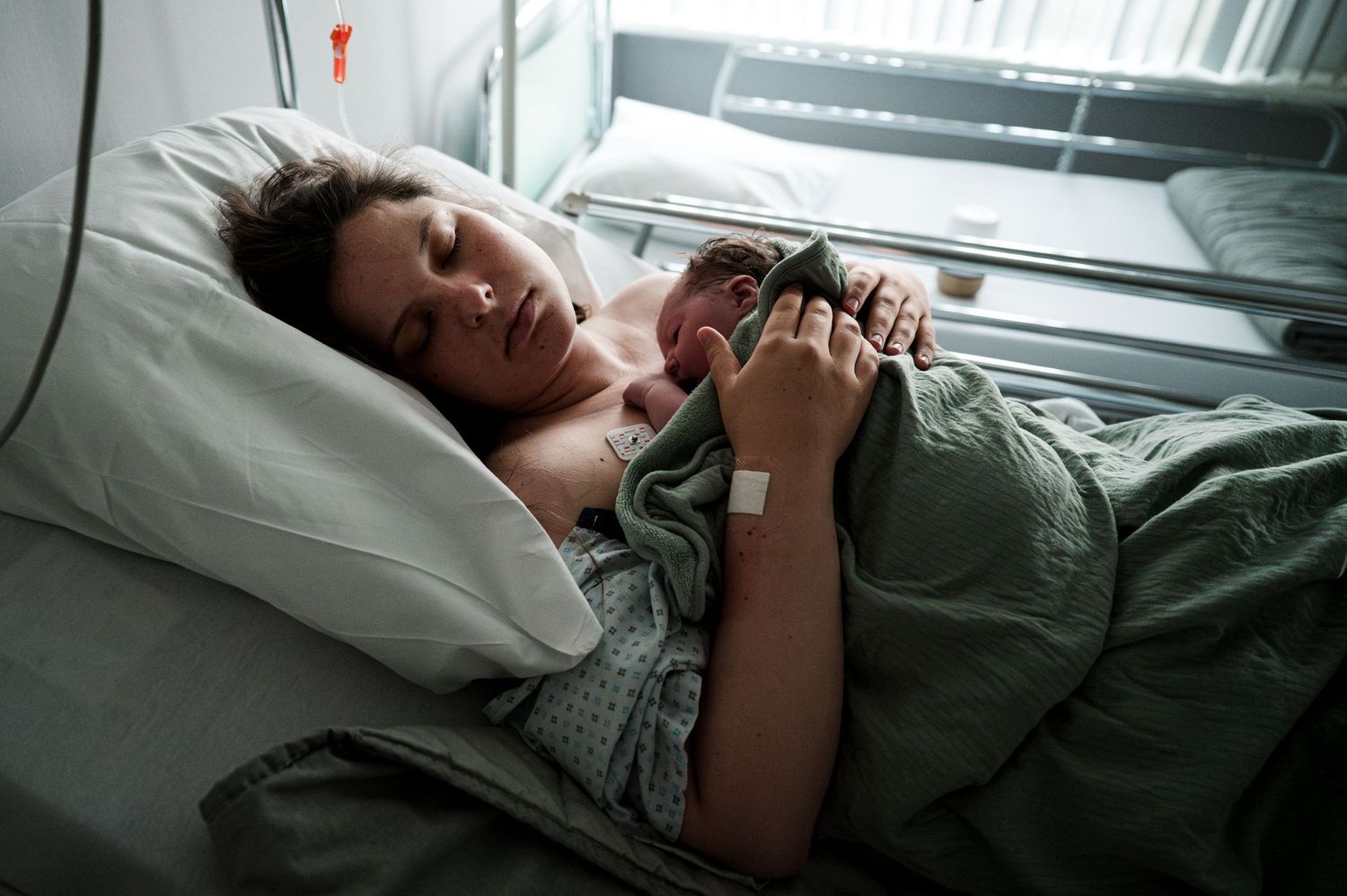 Patient rests in hospital bed with medical bracelet, wearing green gown and lying on white pillow.
