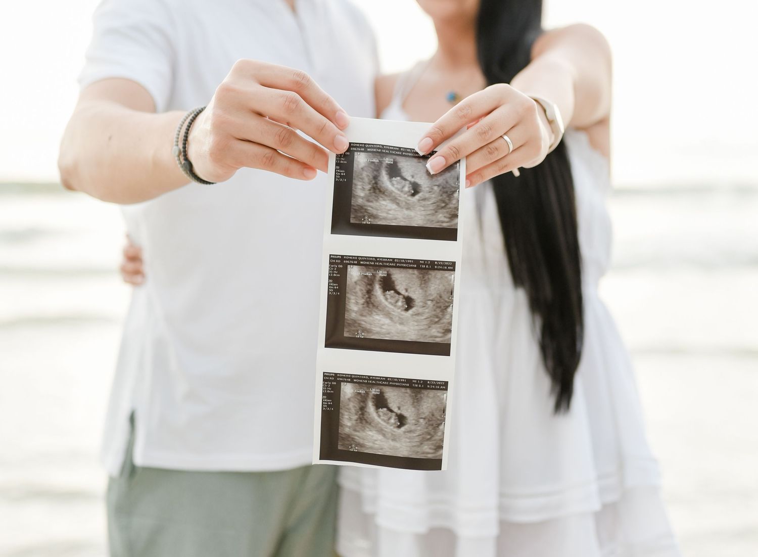 Someone holds up an ultrasound scan image in a bright, modern interior setting.