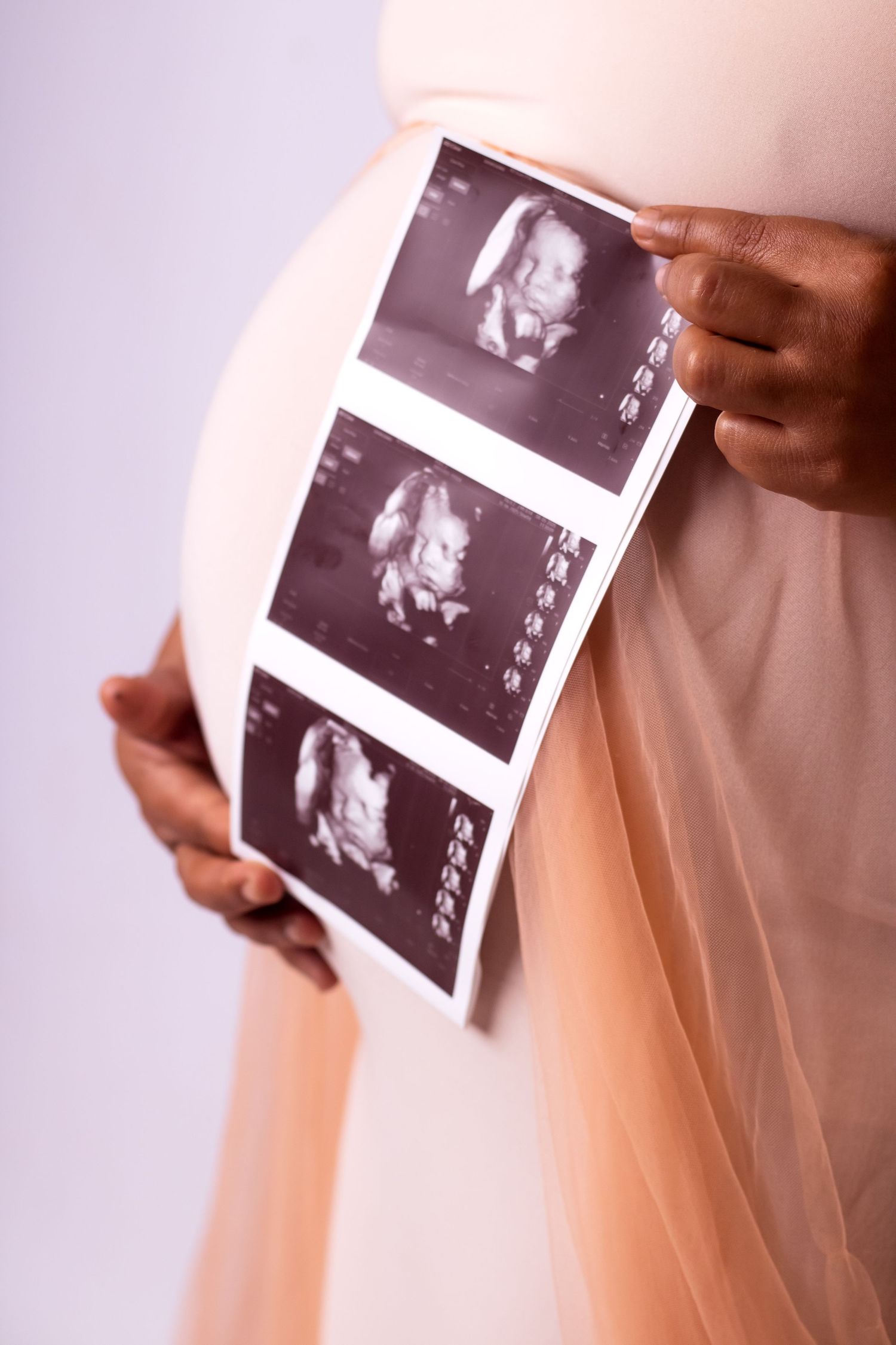 Middelburg Mpumalanga maternity photographer