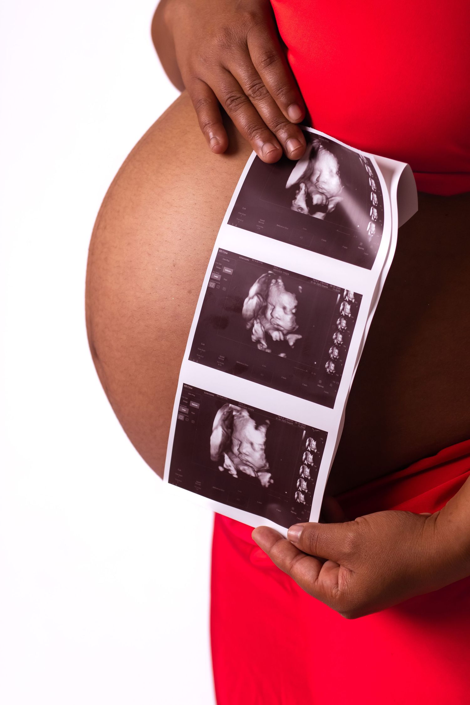 Baby Bump Maternity Photoshoot In Middelburg Mpumalnaga