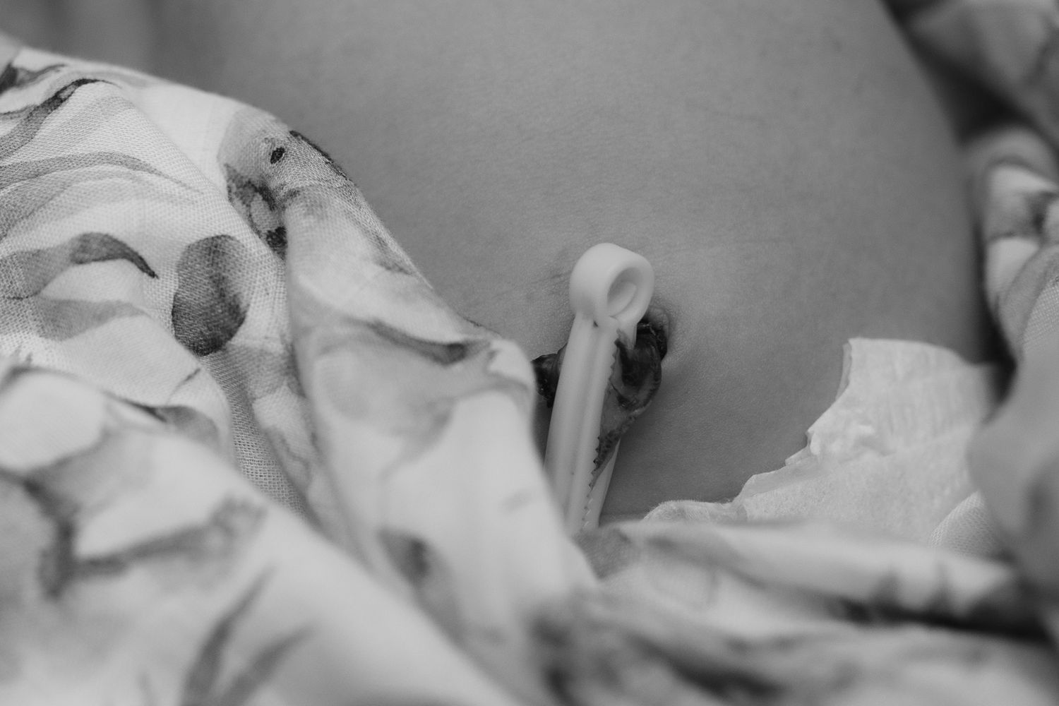 Black and white close-up of a newborn baby's umbilical cord stump on a floral blanket.