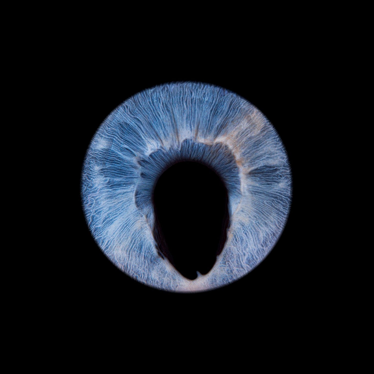 716 iris, coloboma example