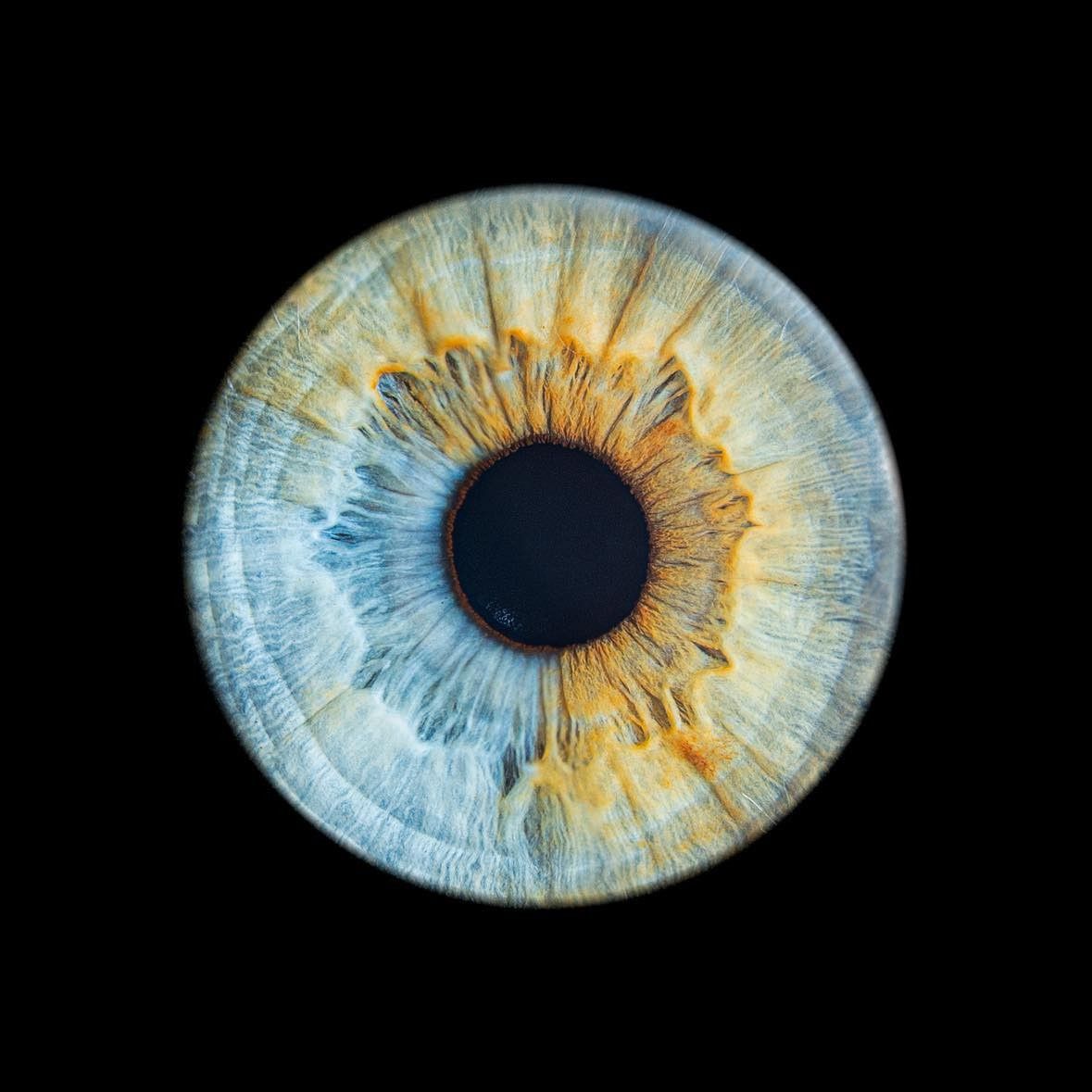Close-up macro photograph of a blue and gold human iris with intricate patterns and fibers against black background.
