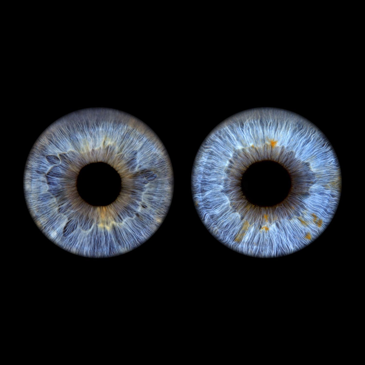 716 iris Close-up of two bright blue human irises with detailed patterns and black pupils on a dark background.