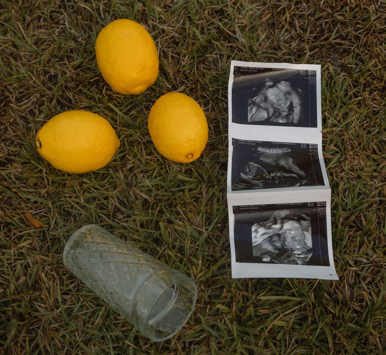 Ultrasound photos laid on grass beside three yellow lemons and an empty glass outdoors.