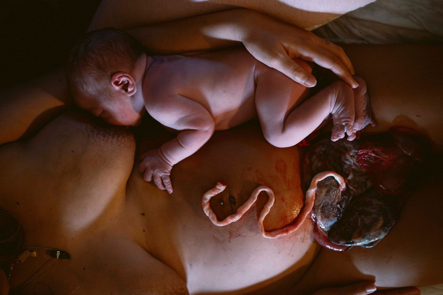 Medical professionals attending to a newborn in a dimly lit setting.