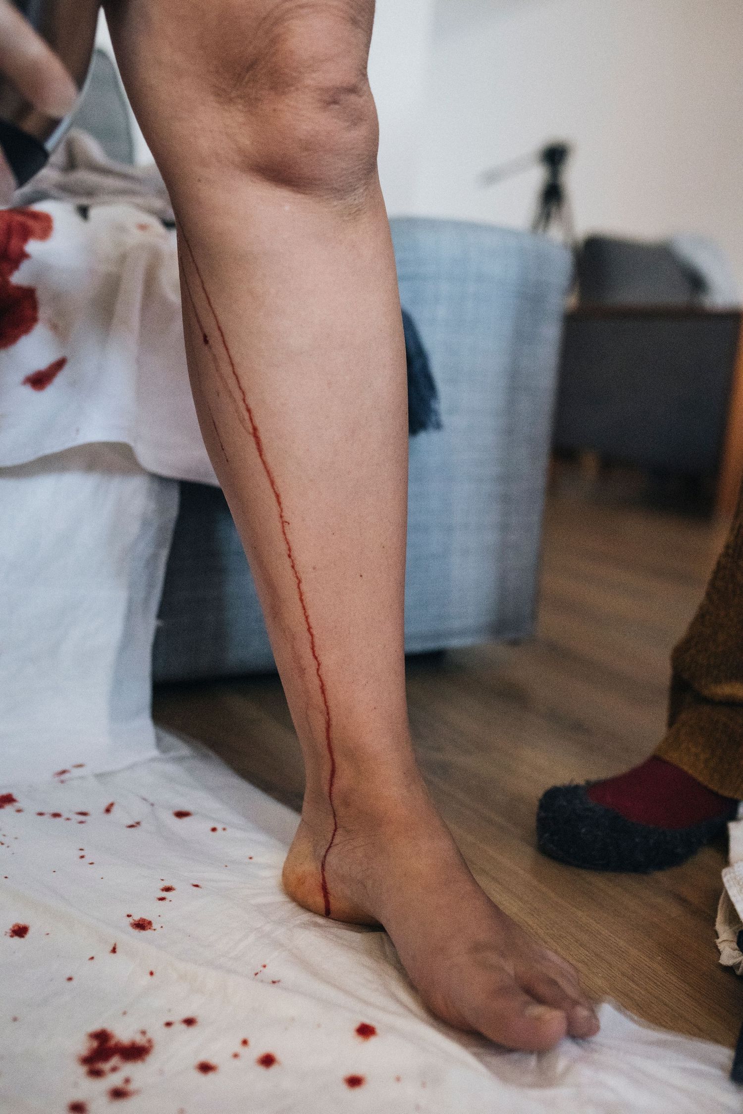 Blood droplets on white sheets near person's bare leg and foot on hardwood floor.