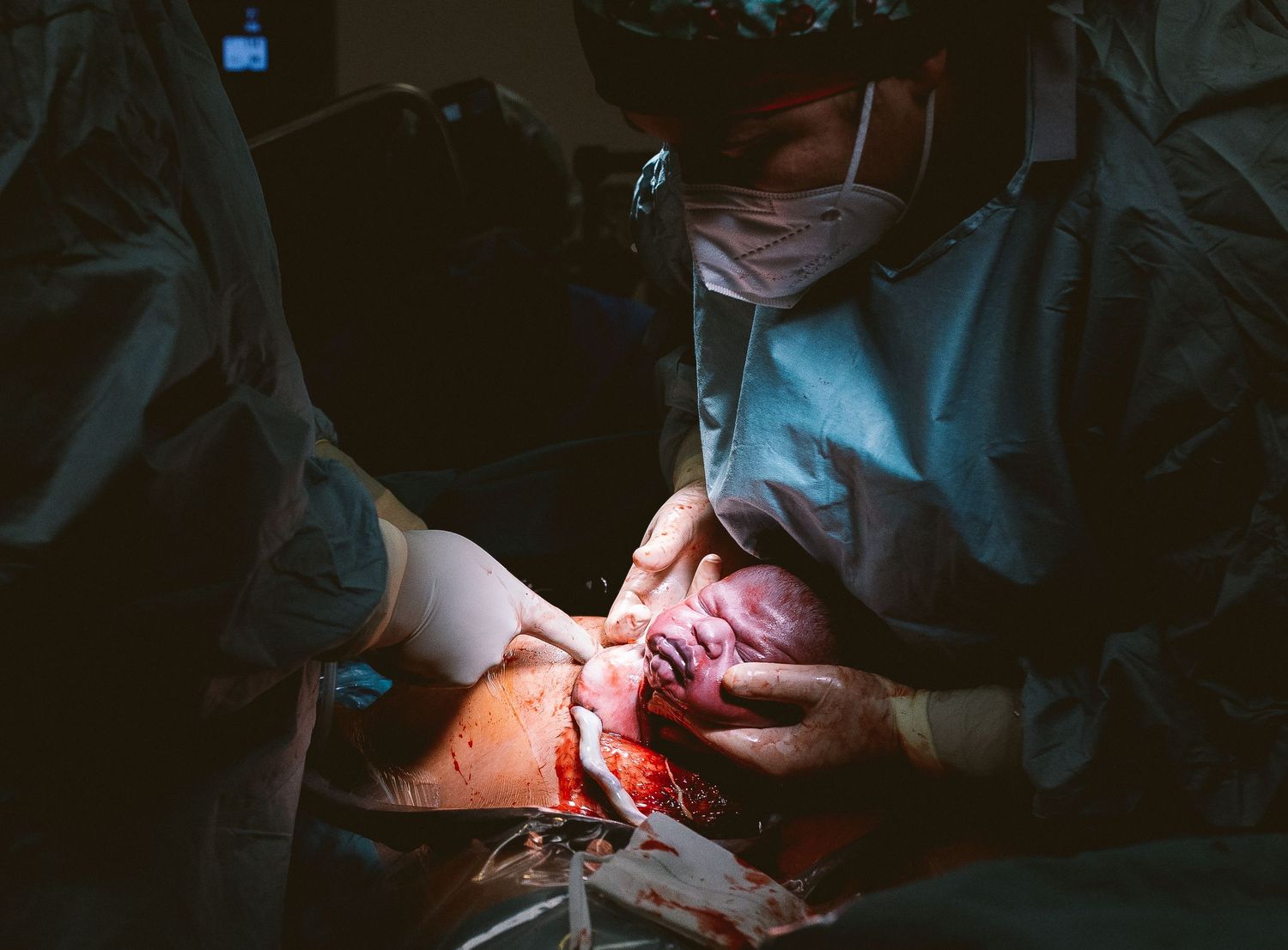 Medical procedure being performed under bright surgical lights in operating room setting.