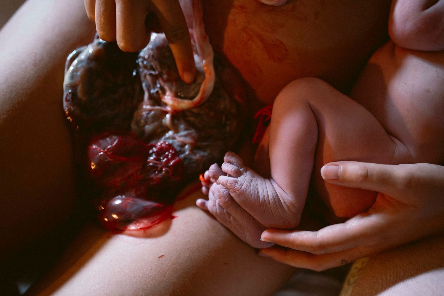 Healthcare workers examining a newborn baby in low light conditions.