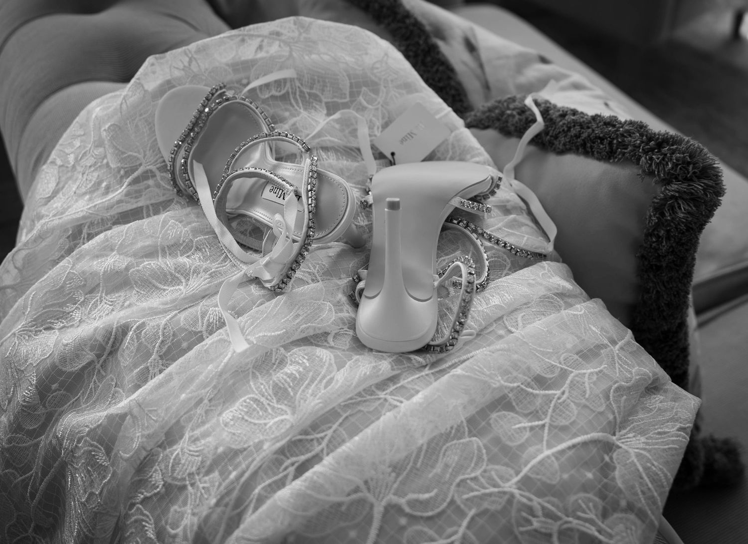 Black and white photo of a baby in lace outfit with a medical device placed on their chest.