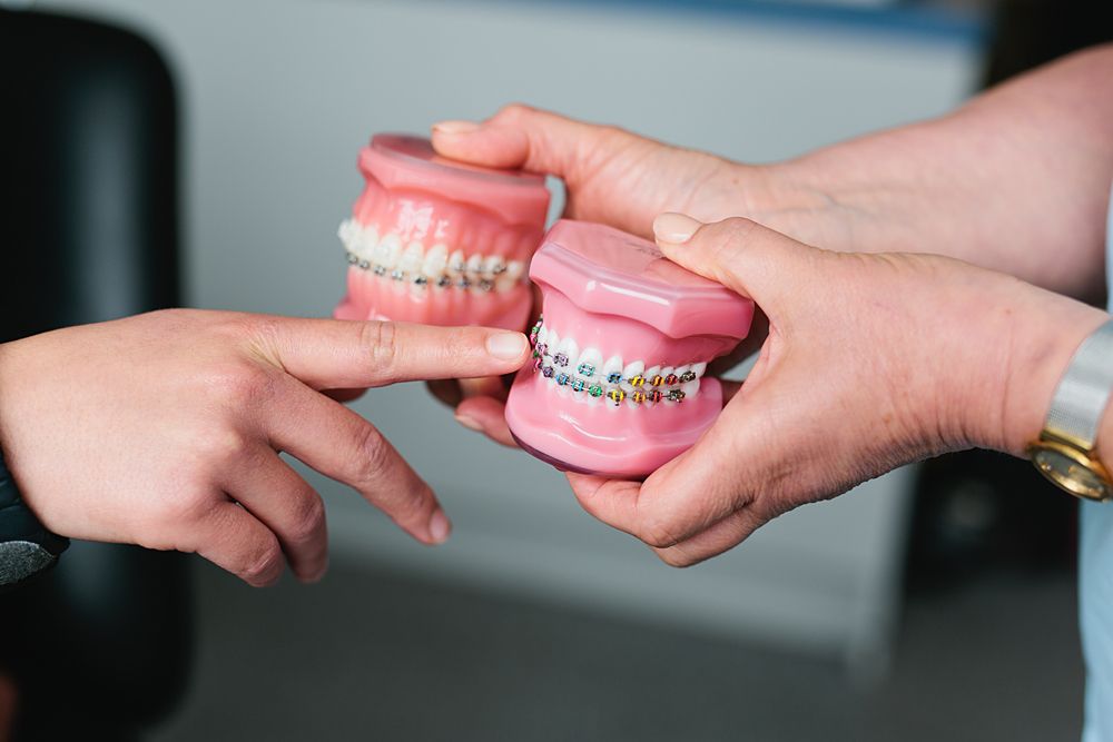 Hands exchanging dental models showing teeth alignments.