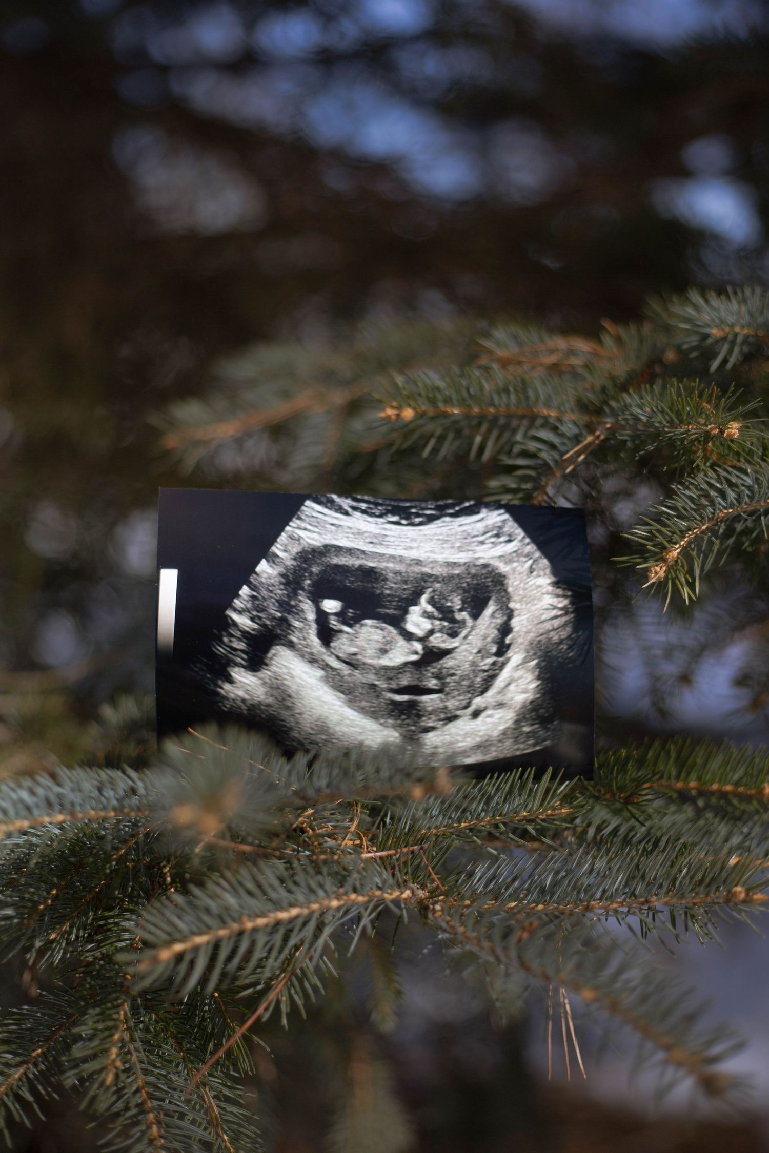 An ultrasound photo displayed against evergreen pine branches in natural lighting.