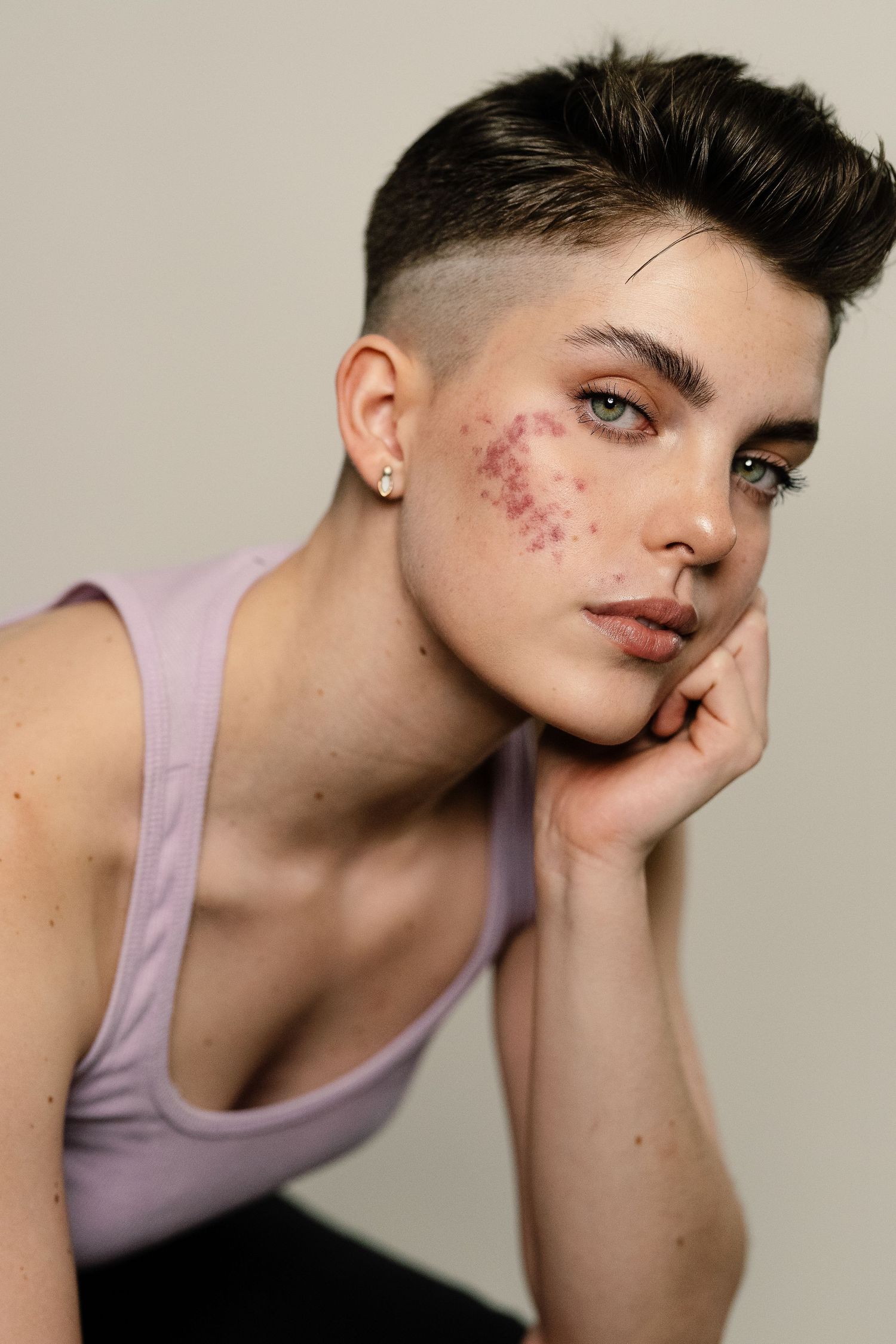 Young person with short hair and acne on cheek poses thoughtfully, resting chin on hand against neutral background.