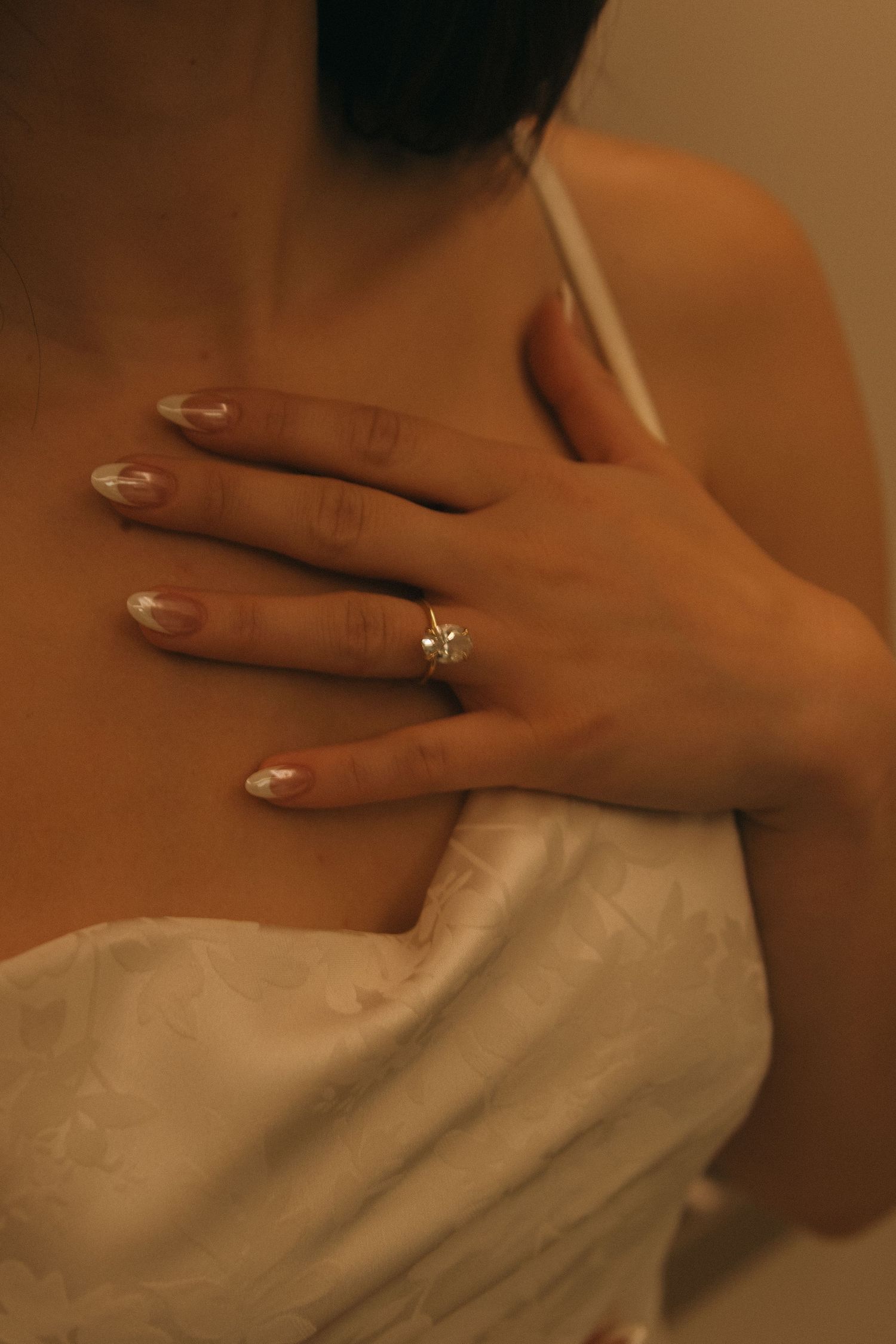 Close-up shot of a hand with a wedding ring resting on white fabric.
