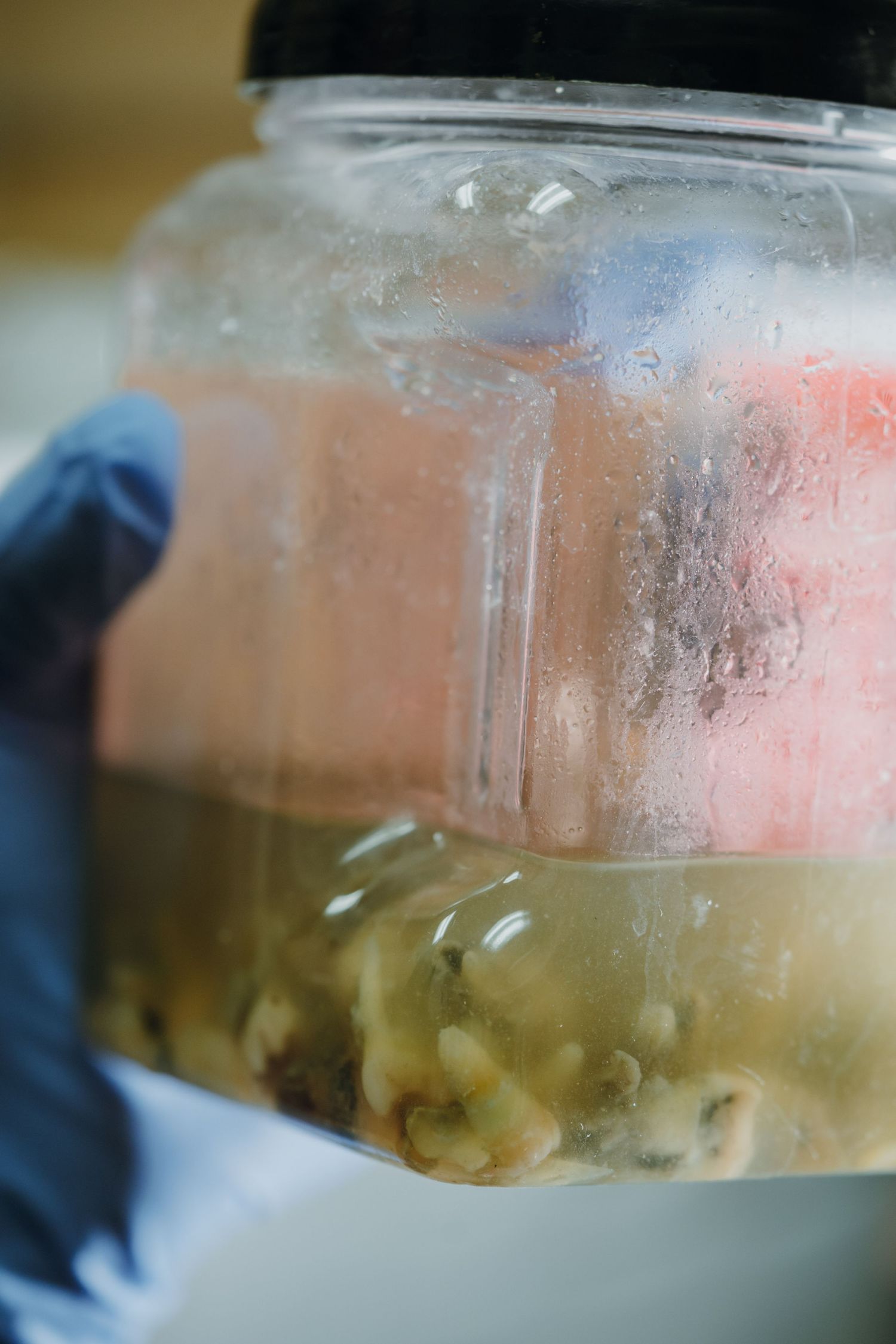 A gloved hand holds a clear container with dental impressions submerged in liquid.