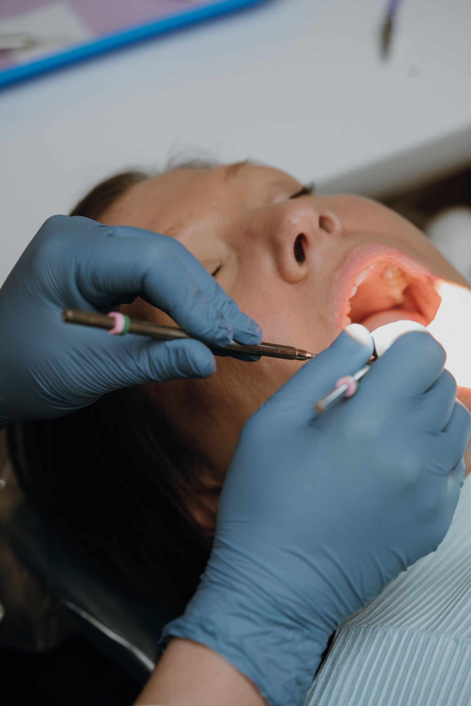 A dentist in blue gloves performs a dental procedure on a patient lying in a dental chair.