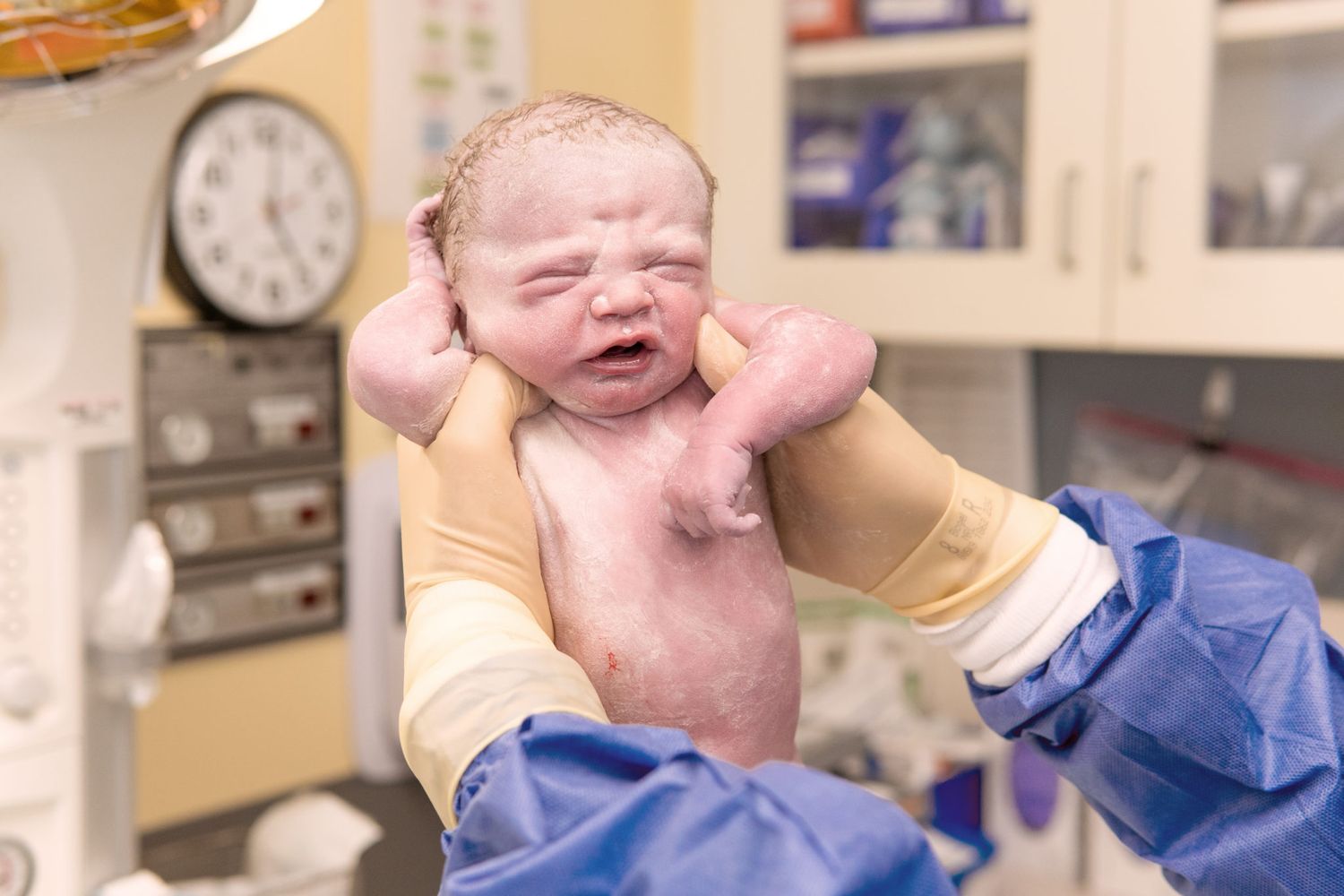 A baby wearing a blue shirt cries while getting medical care at a doctor's office or hospital.