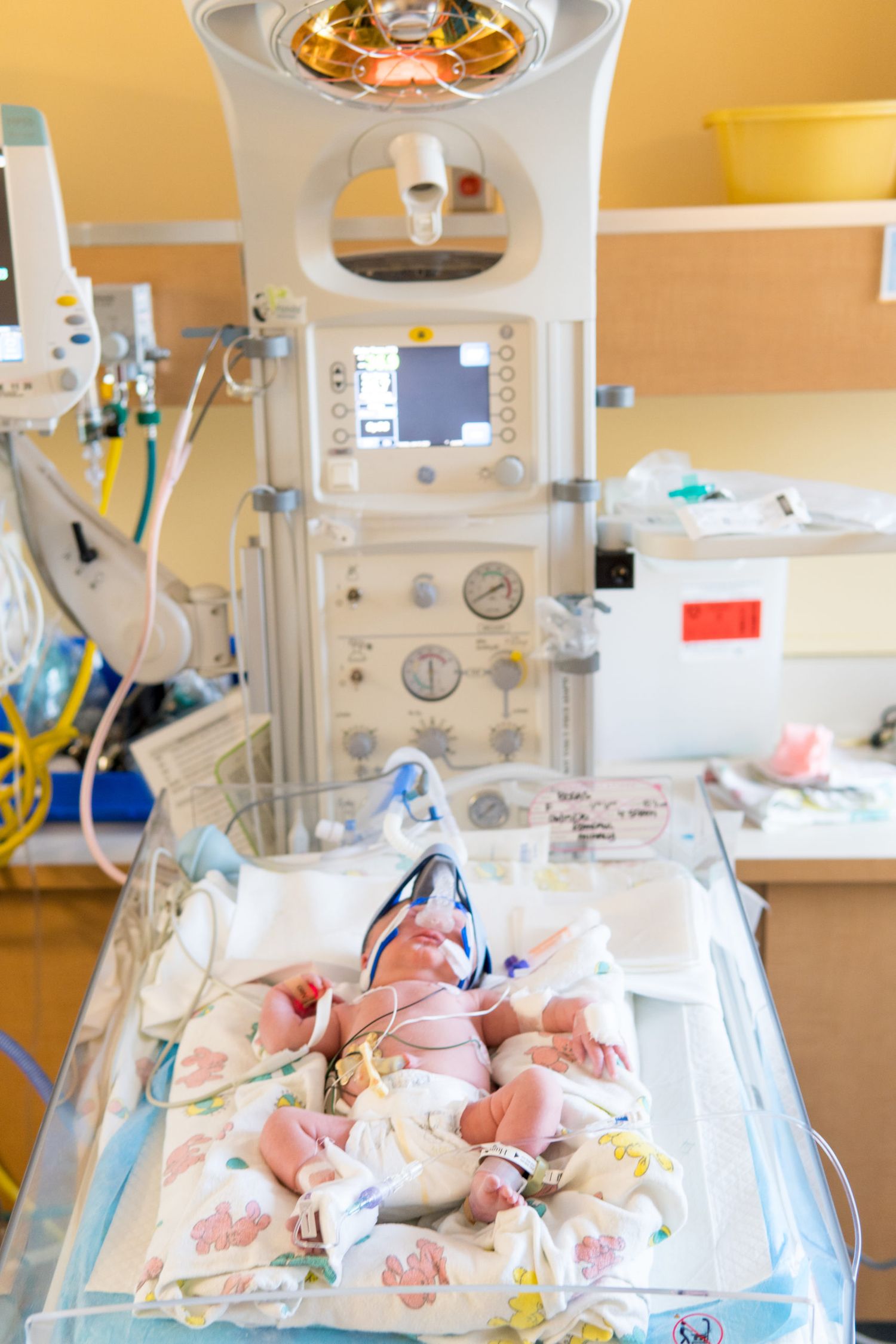 Medical dialysis machine in hospital room with treatment equipment and supplies on bed.