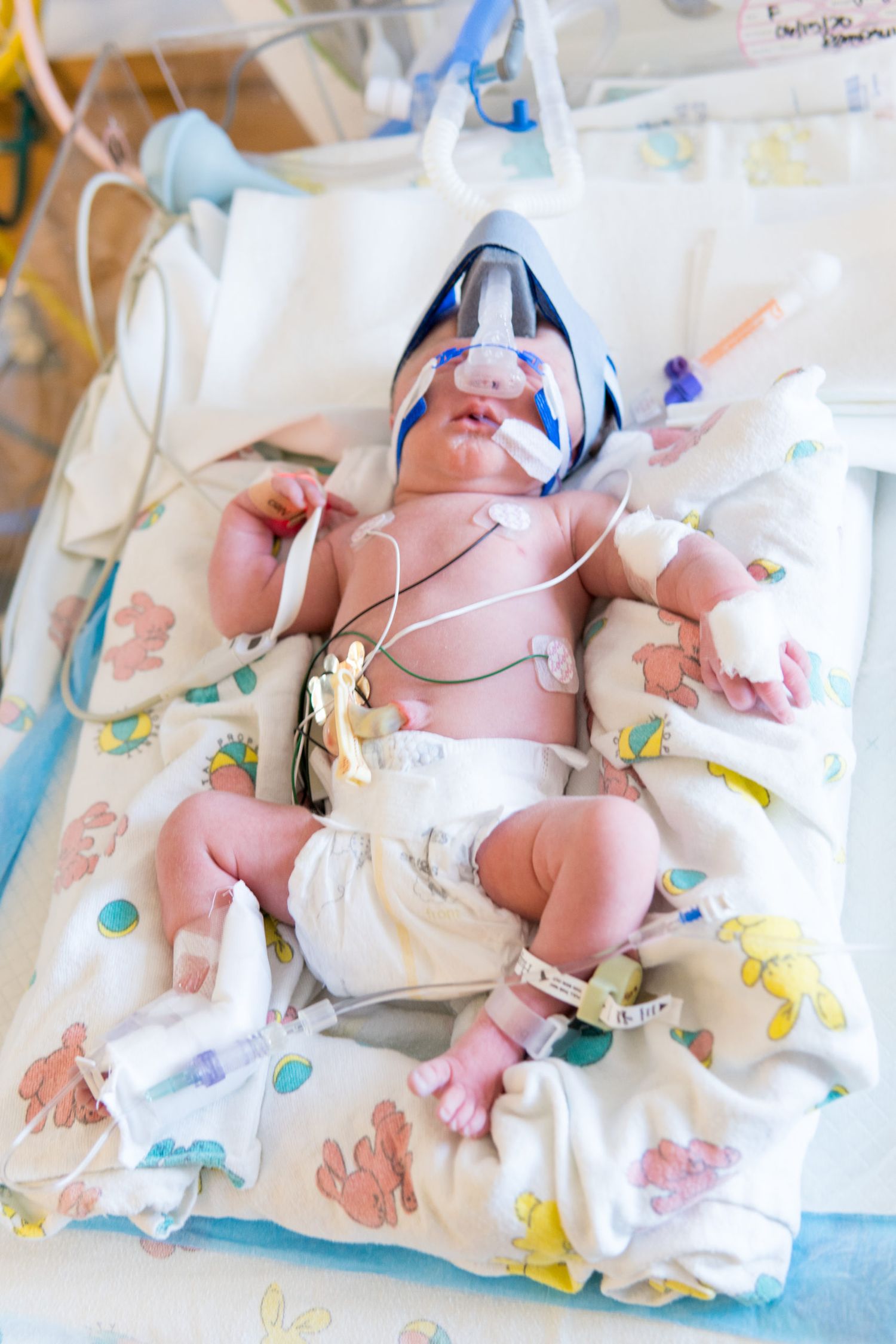 Newborn baby lying on colorful patterned blankets in a hospital setting with medical monitoring equipment.