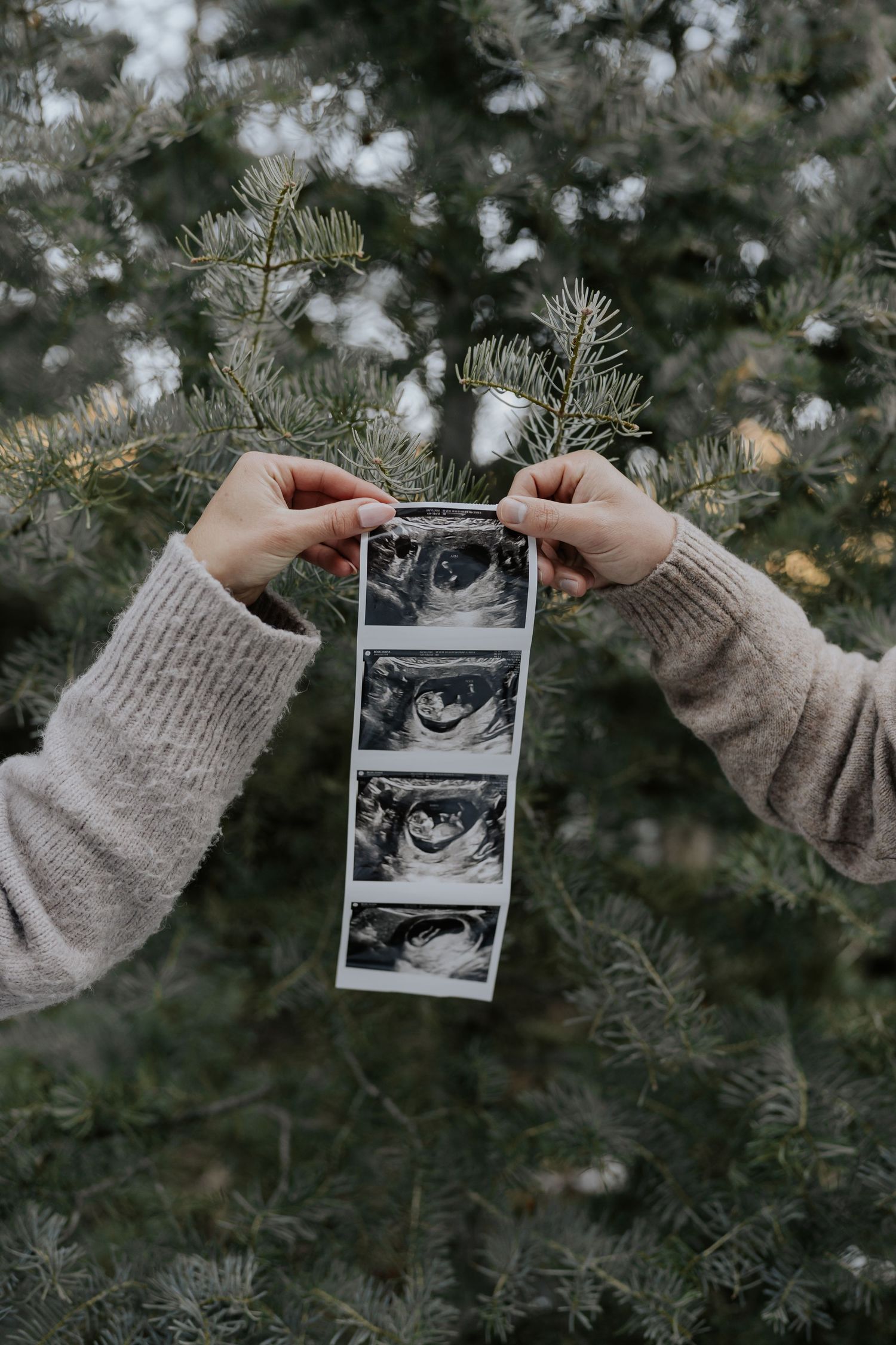 Hands holding ultrasound photo strip in front of pine tree branches during maternity session.