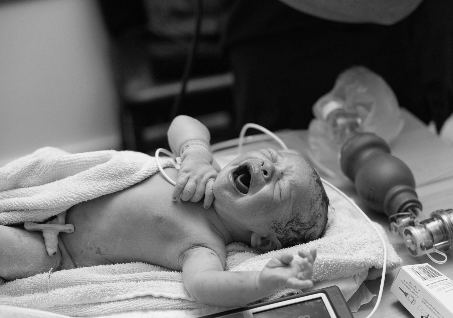A black and white photograph of a newborn baby laying on a hospital bed with nasal tubes.