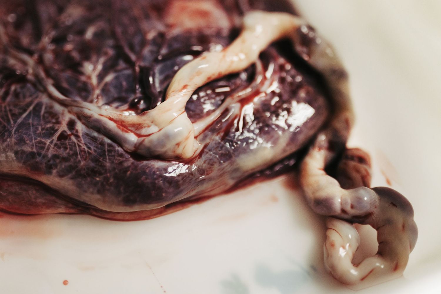 Birth photography of a delivered placenta in Boise
