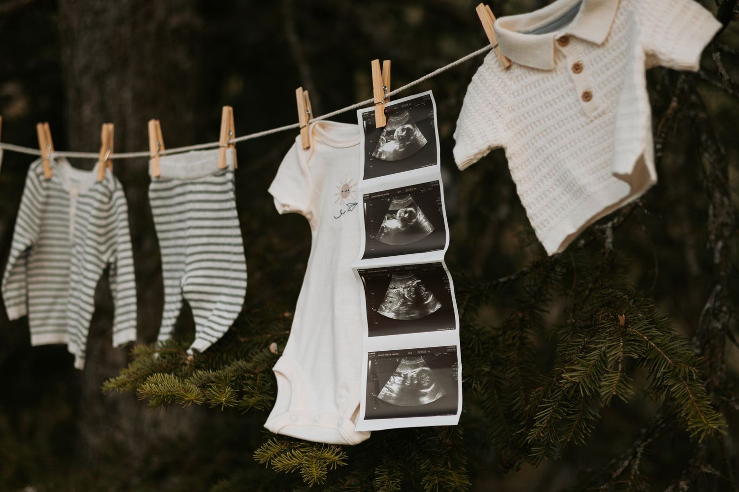 Baby clothes and ultrasound photos hang on clothesline against dark background.
