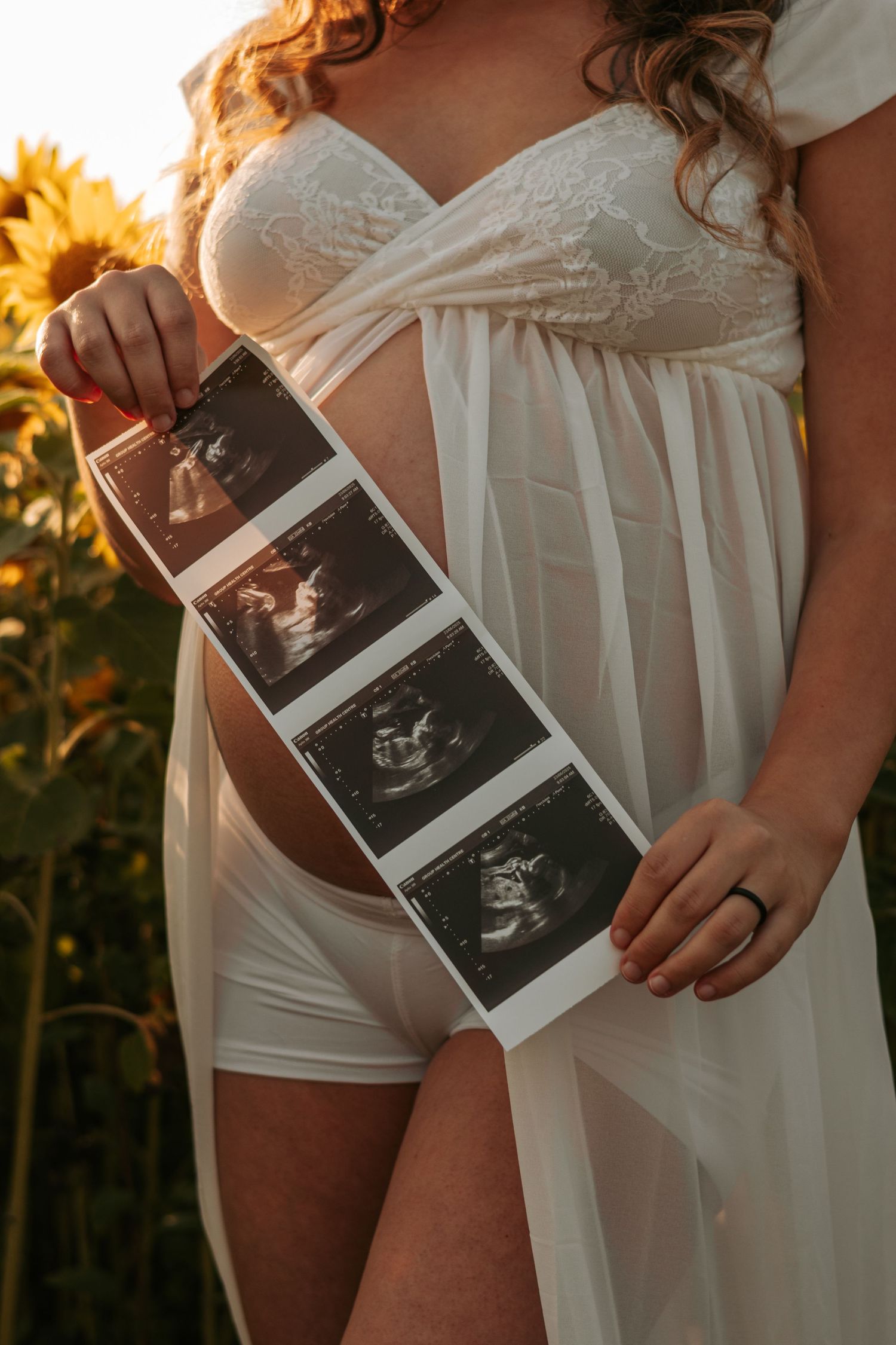 Pregnancy photoshoot with ultrasound photos in white dress among sunflowers.