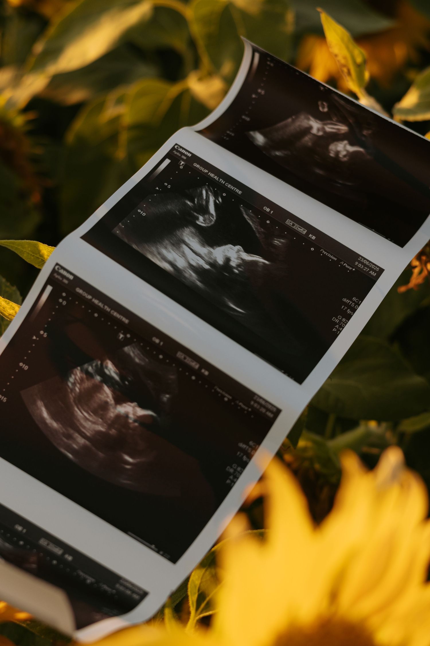 Ultrasound photos arranged against autumn leaves background.