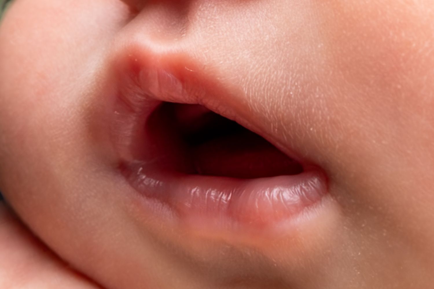 Close-up of a newborn baby's mouth and lips showing early teething signs with swollen gums.