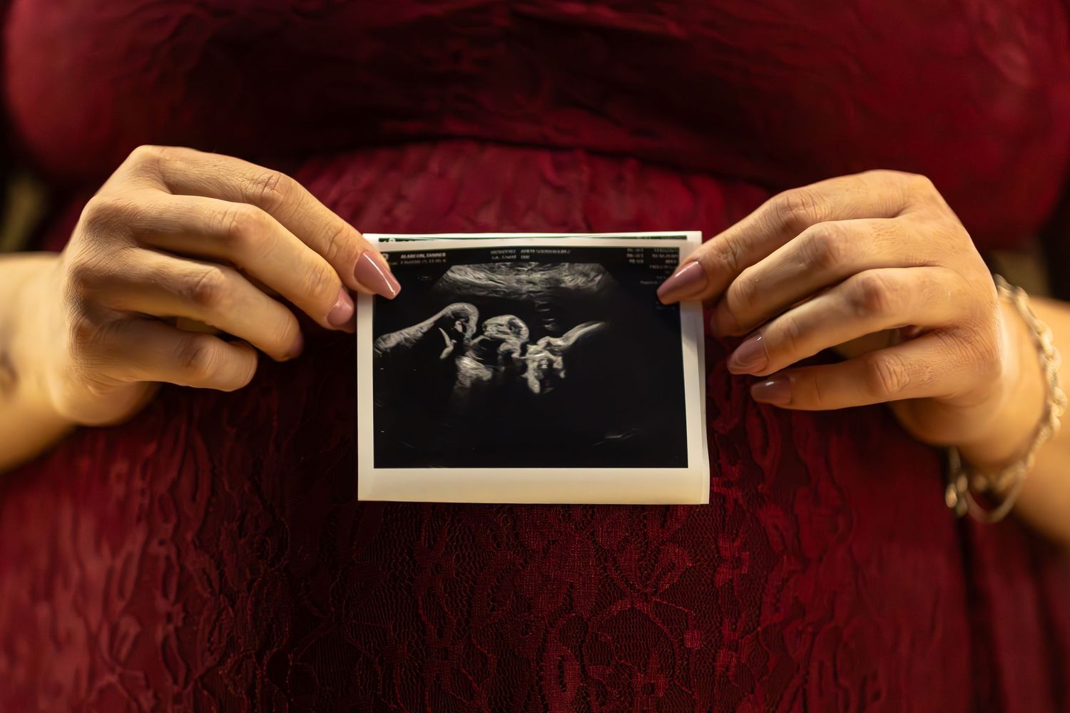 Hands holding and displaying a series of black and white ultrasound images against a red background.