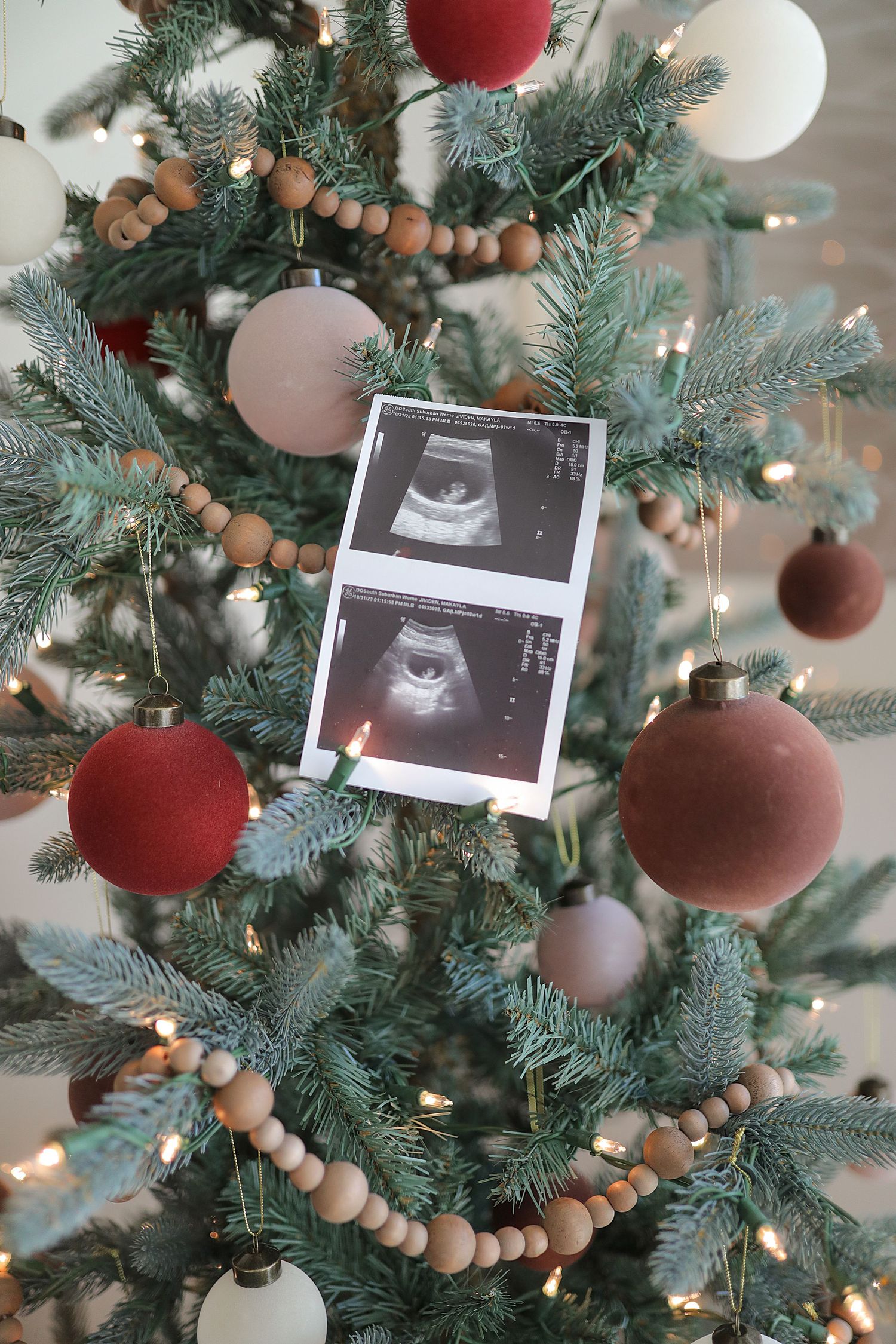Ultrasound images displayed on a Christmas tree decorated with red ornaments and wooden beads.