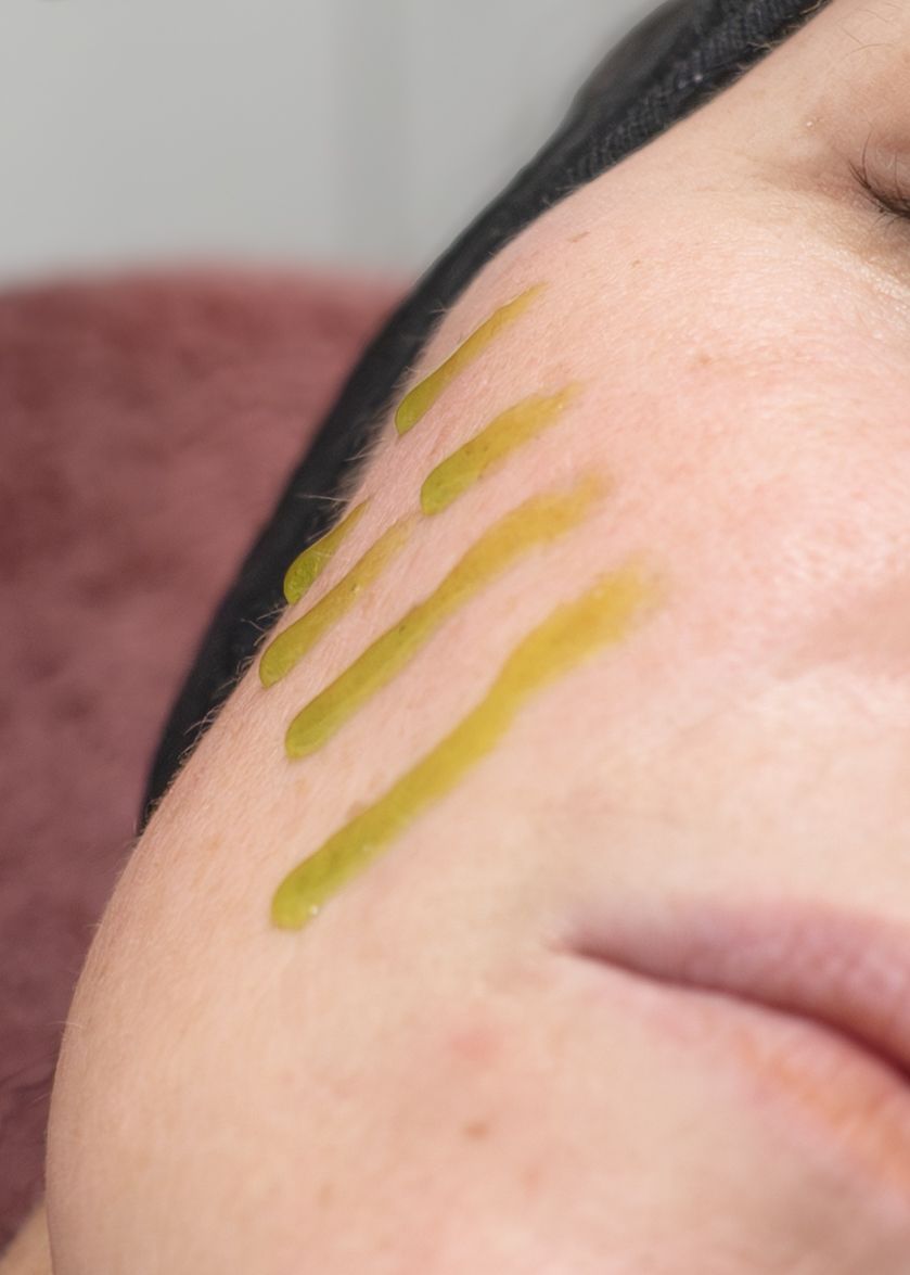 Close-up of olive green facial oil serum swatches applied to a woman's cheek during a skincare treatment.