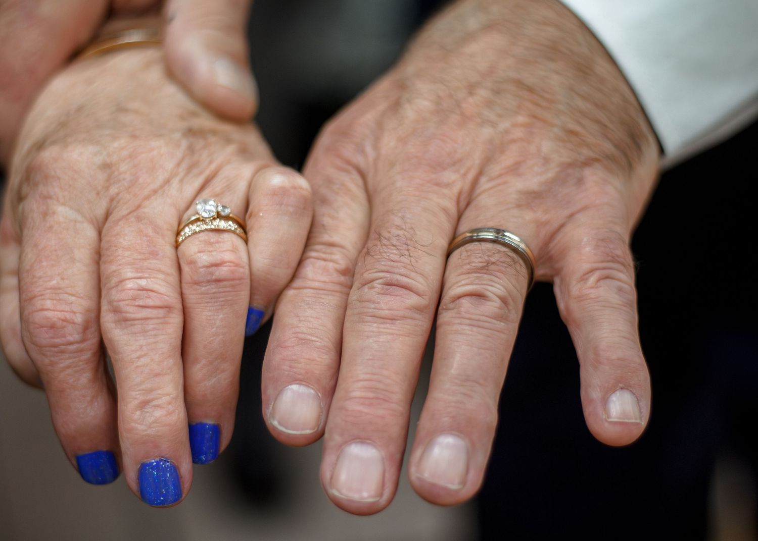 Two elderly hands with wedding rings displayed side by side, one with blue painted nails, symbolizing marriage and commitment.