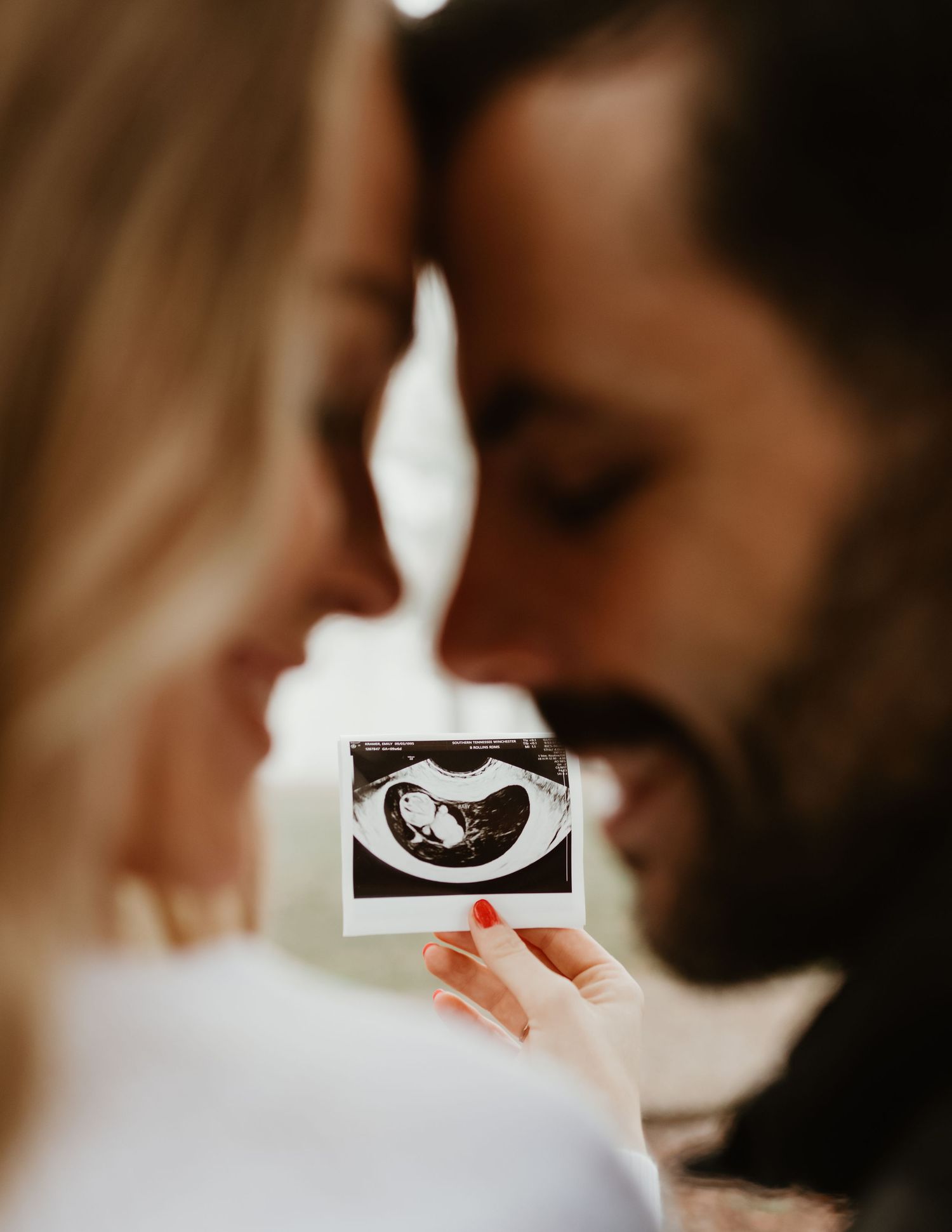 A couple holding up an ultrasound photo while sharing an intimate moment together.
