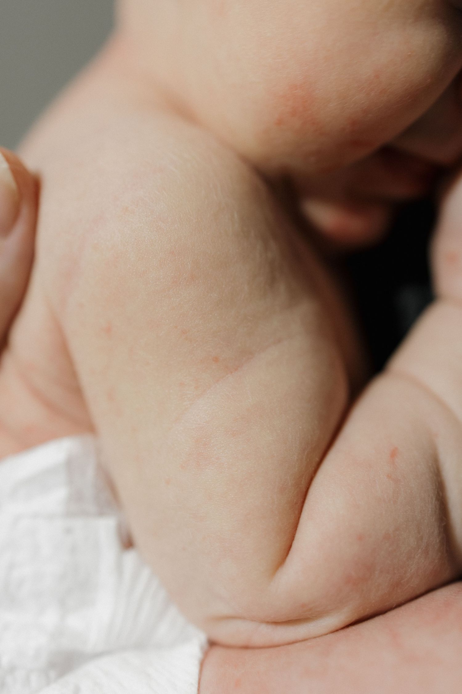 Close-up macro shot of a baby's soft skin and chubby arm folds.