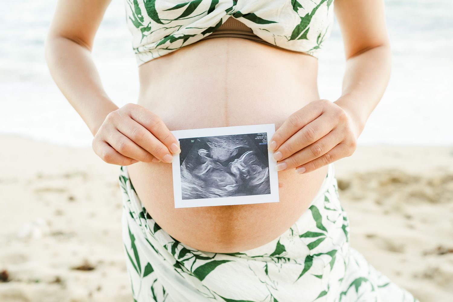 A pregnant belly in a floral dress holds a black and white ultrasound photo against the sand. Oahu Newborn Photographer