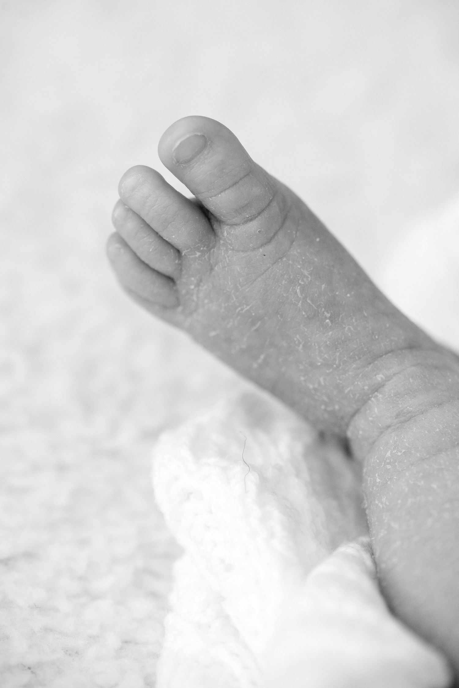 Black and white macro photo of a newborn baby foot with tiny toes and delicate peeling skin.