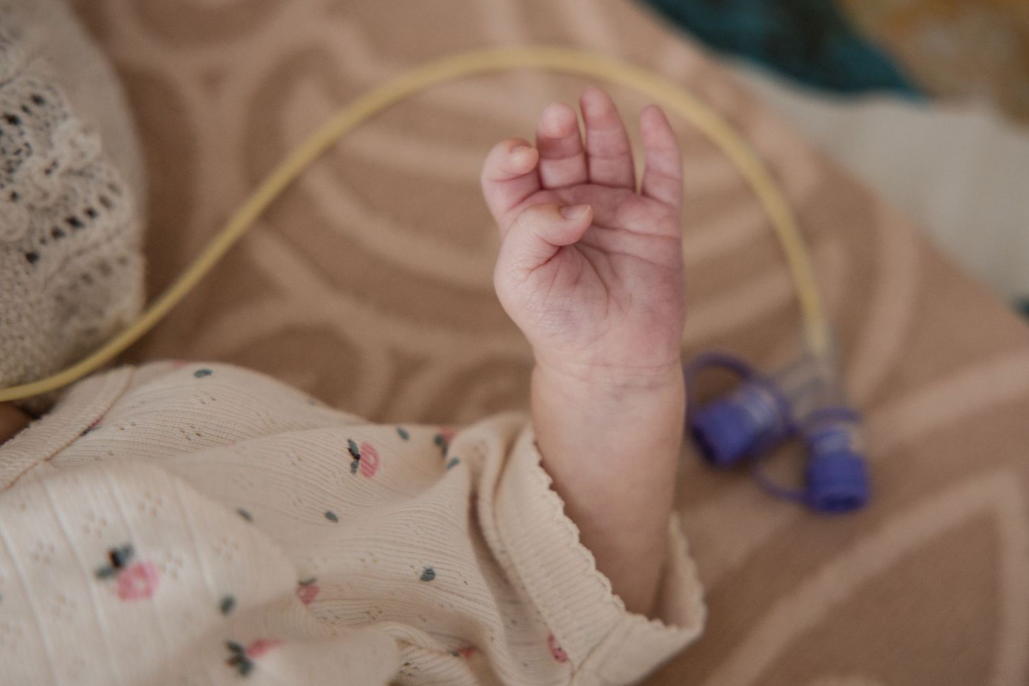 Close-up of a premature baby's small fist with a medical tube attached, resting on a floral blanket.
